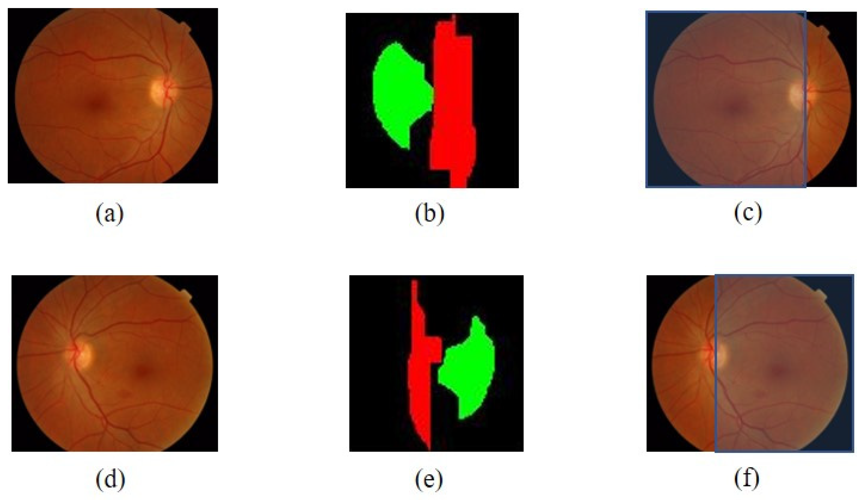 Symmetry 15 01631 g006