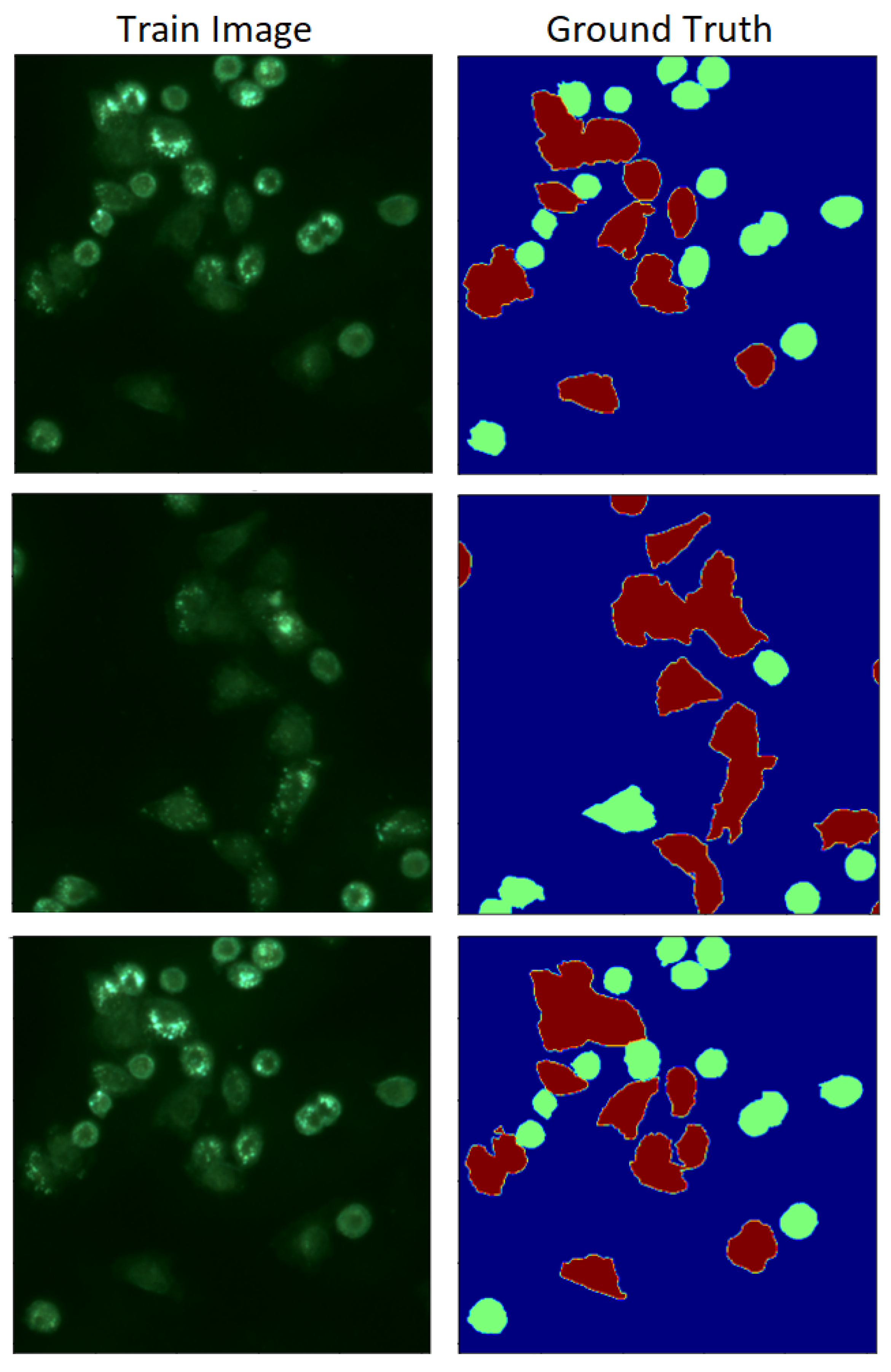 lsm.jpg4.us | imagesize: ga-157" Symmetry Breaking in the U-Net: Hybrid Deep-Learning Multi-Class  Segmentation of HeLa Cells in Reflected Light Microscopy Images