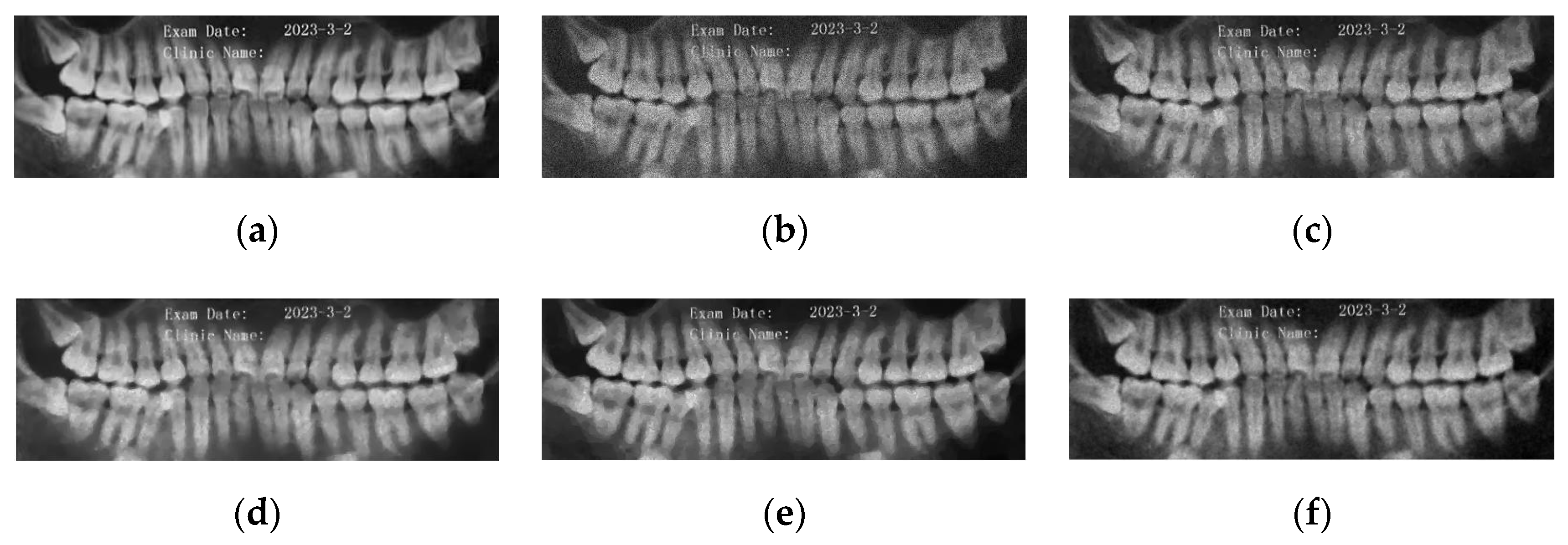 Symmetry 16 00258 g012