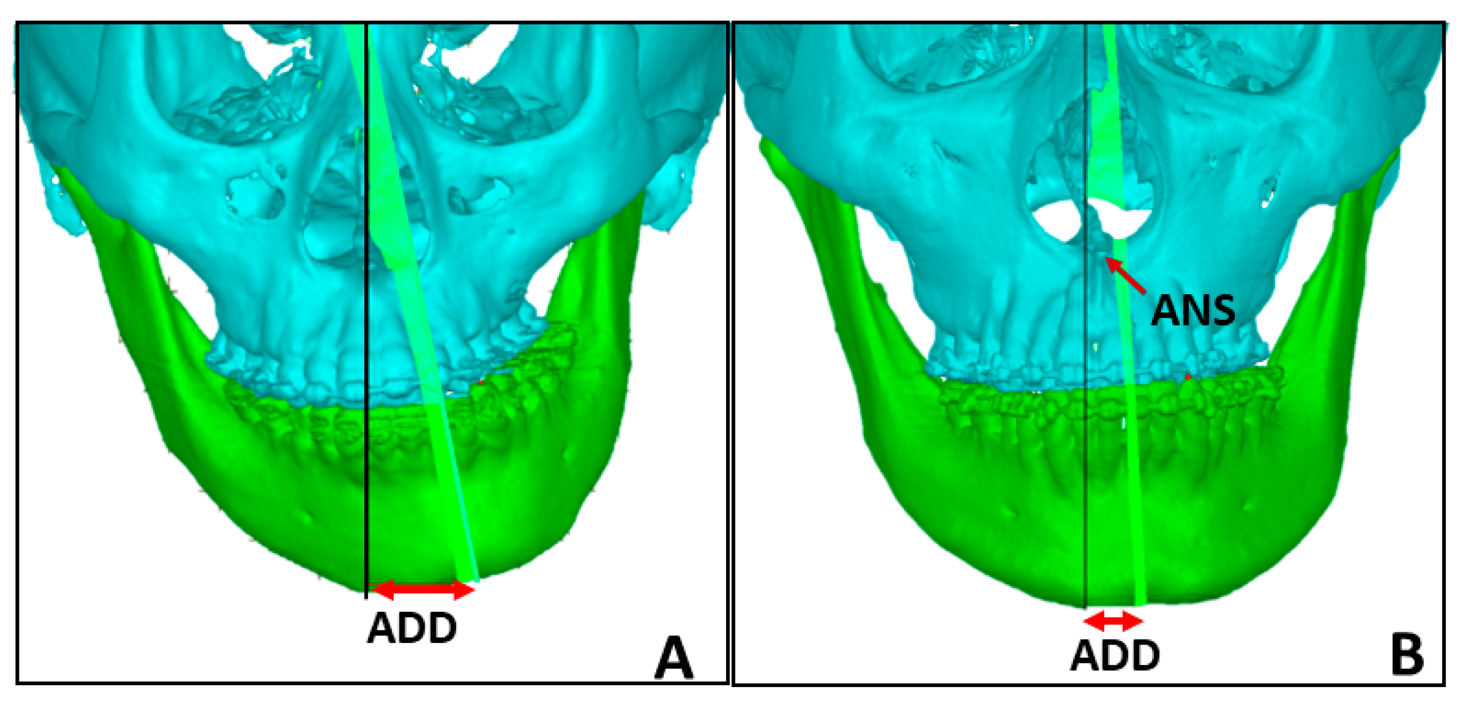 Symmetry 16 00490 g001
