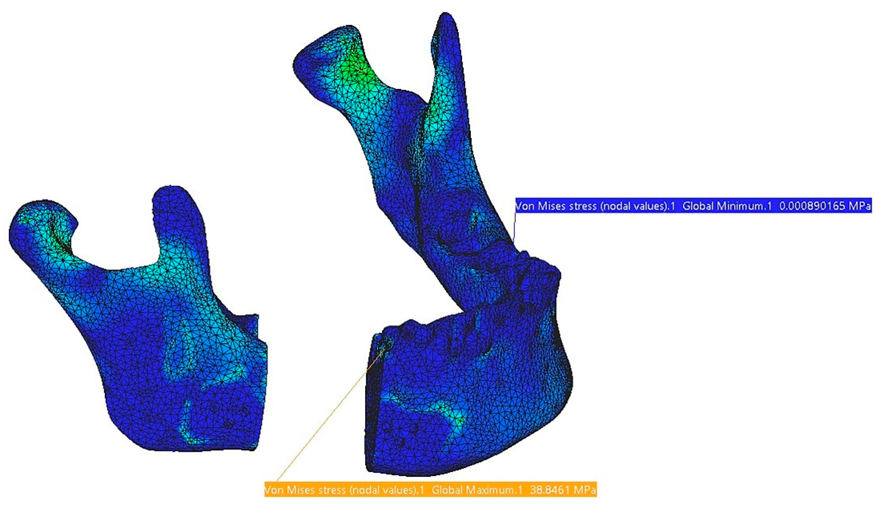 Symmetry 17 00499 g018