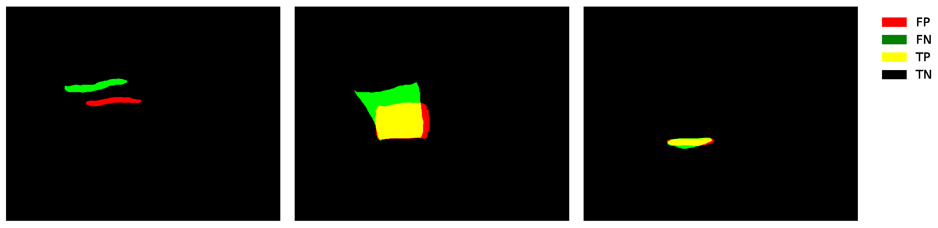 Symmetry 17 02014 g008