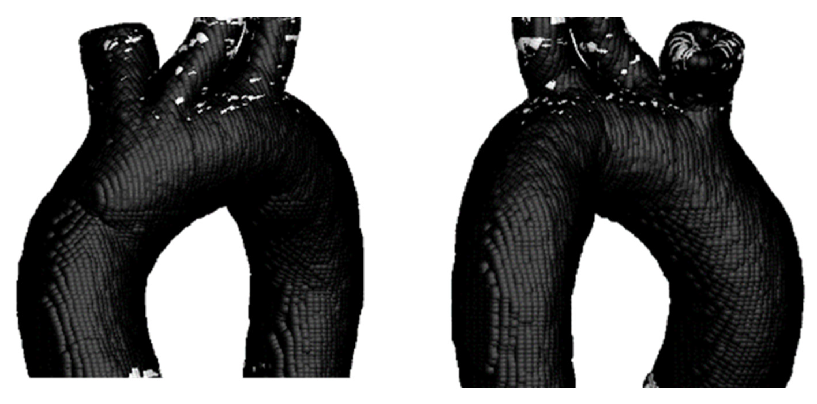 Symmetry 18 00143 g014