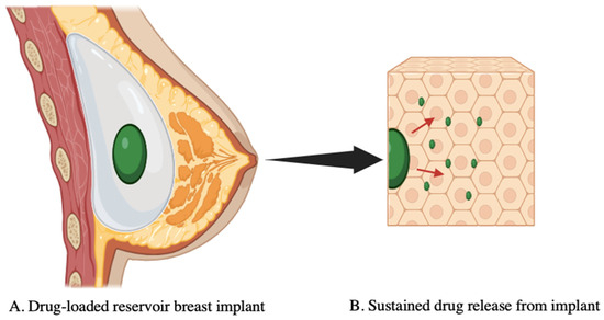 Targeted and Localized Therapeutic Delivery for Breast Cancer: Current Technologies, Translational Challenges, and Future Innovations