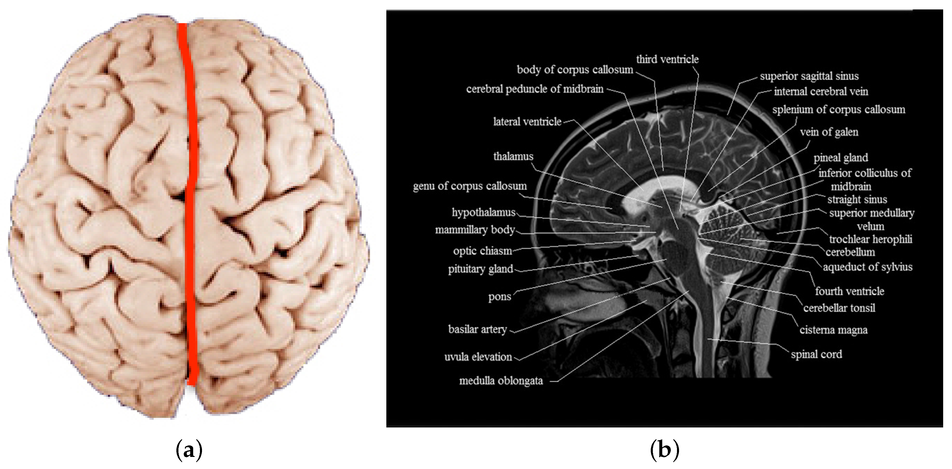 human brain mapping and florence