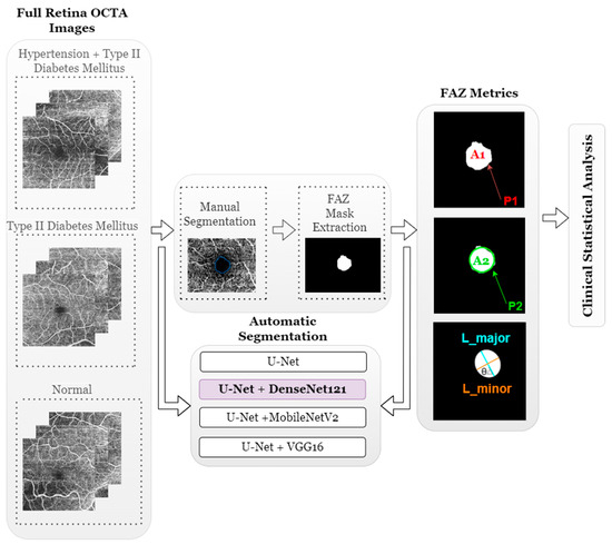 Automatic Segmentation and Statistical Analysis of the Foveal Avascular ...
