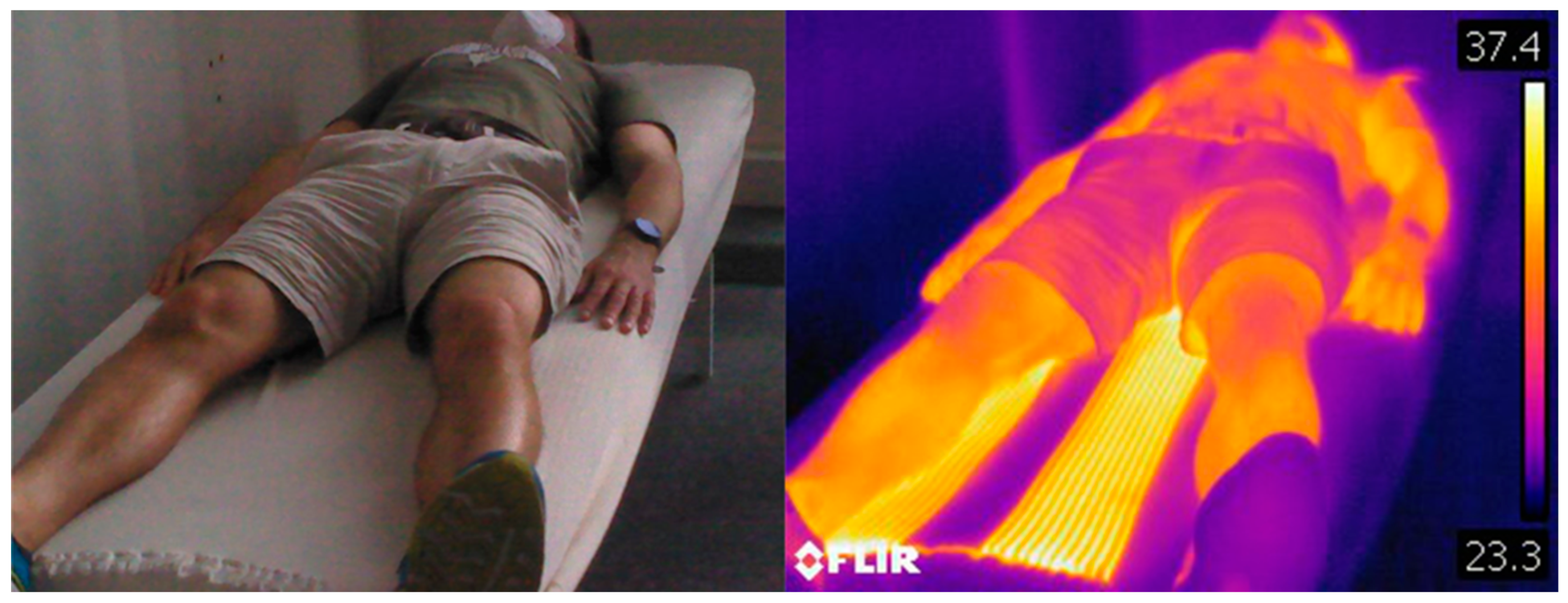 Textiles 03 00006 g022