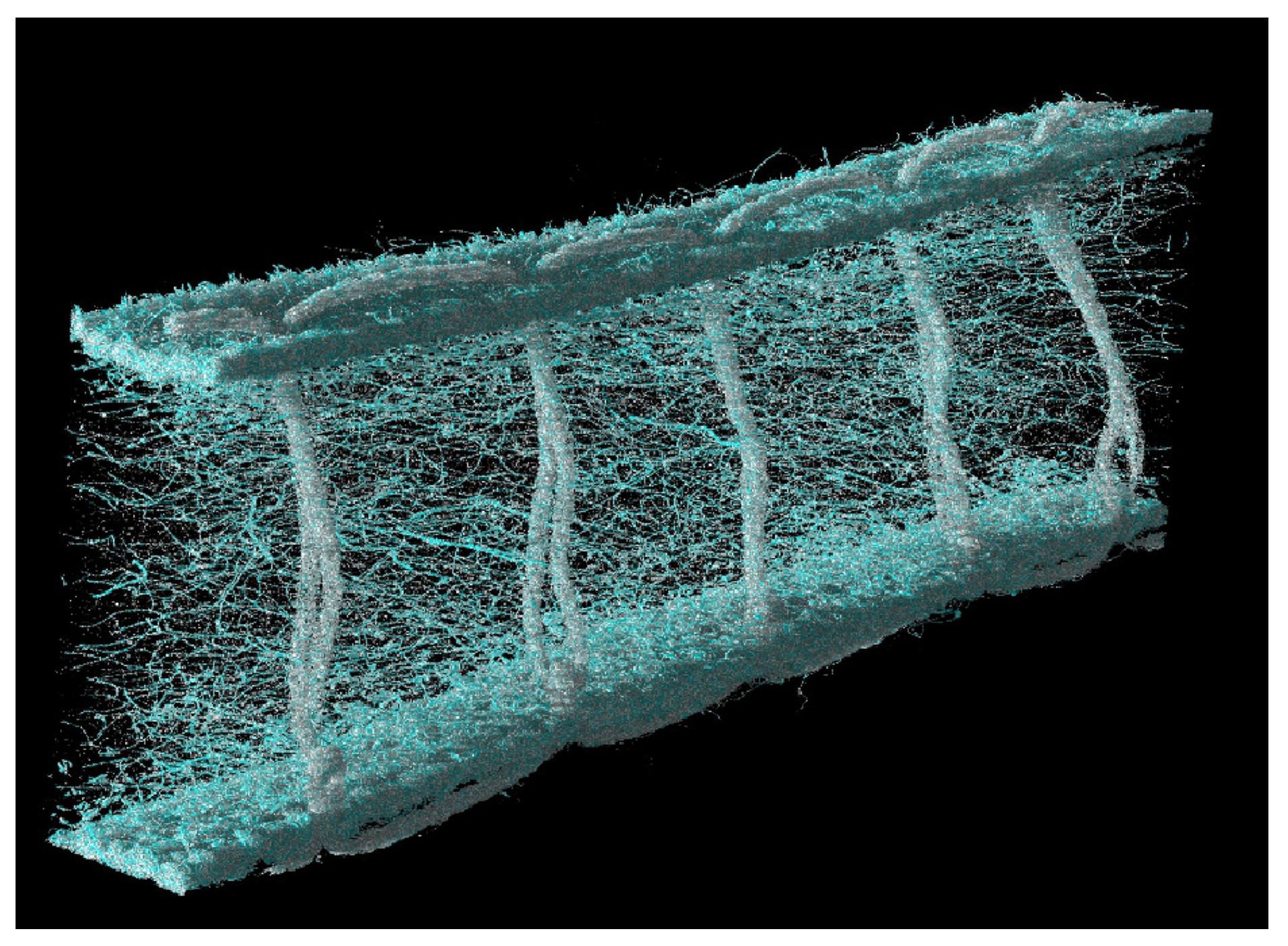 Textiles 05 00023 g005b