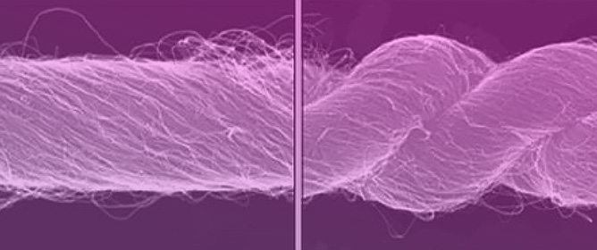 Actuator Materials: Review on Recent Advances and Future Outlook for Smart Textiles