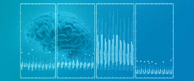 Brain Sciences An Open Access Journal From Mdpi