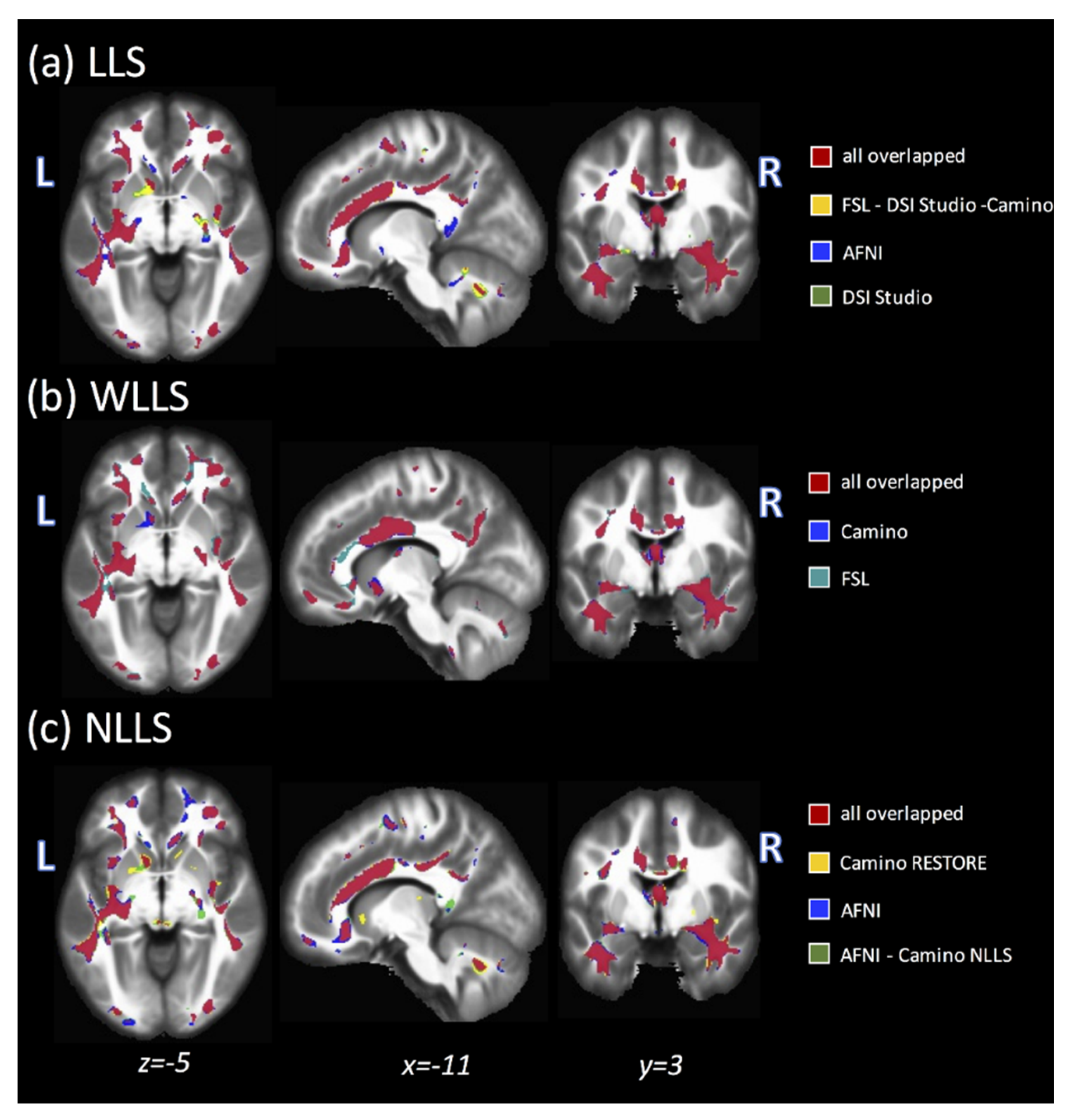 Tomography 07 00003 g003