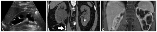 Tomography 07 00008 g002 550
