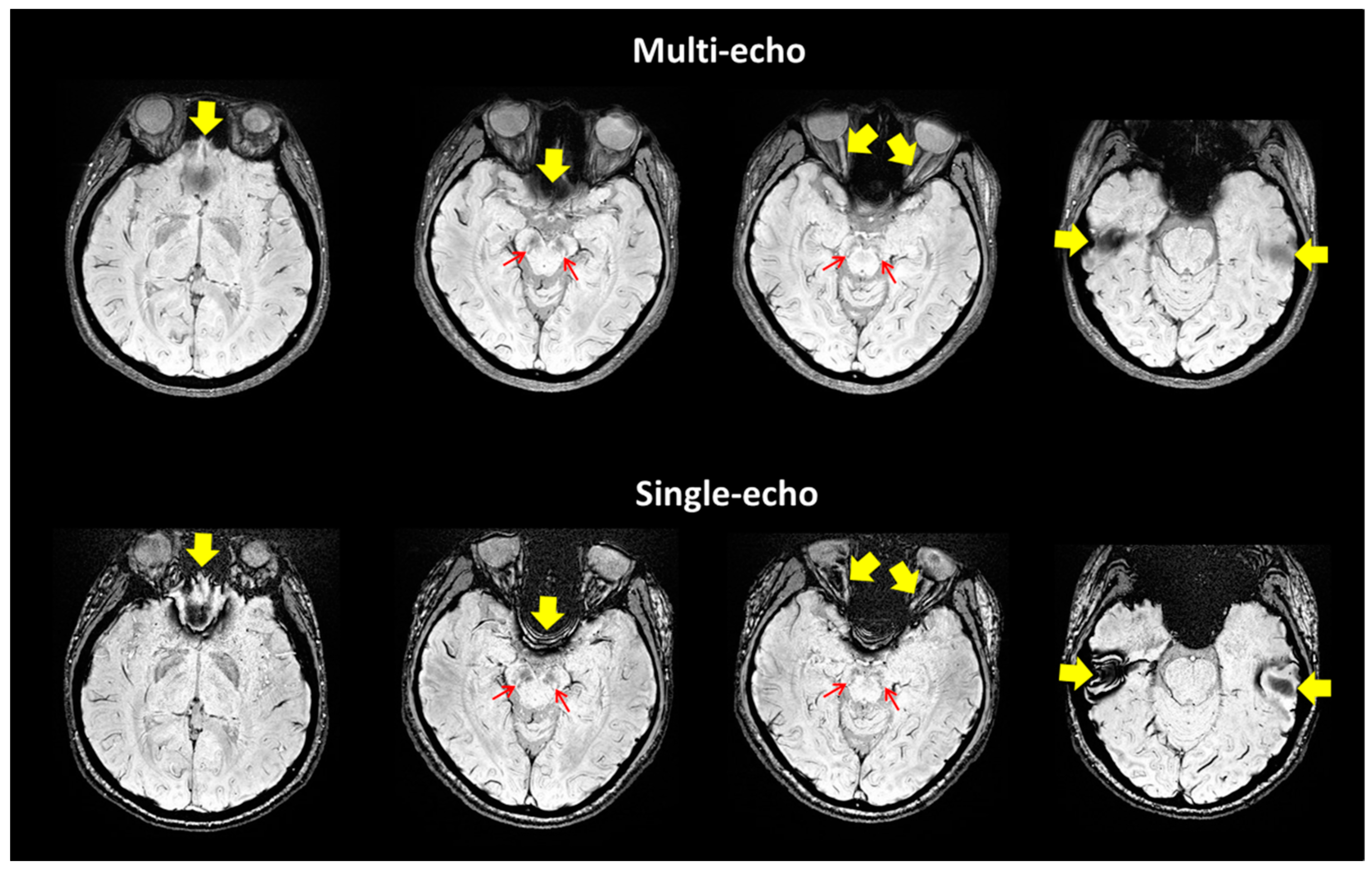 Tomography 07 00010 g003 Tomography 07 00010 g003