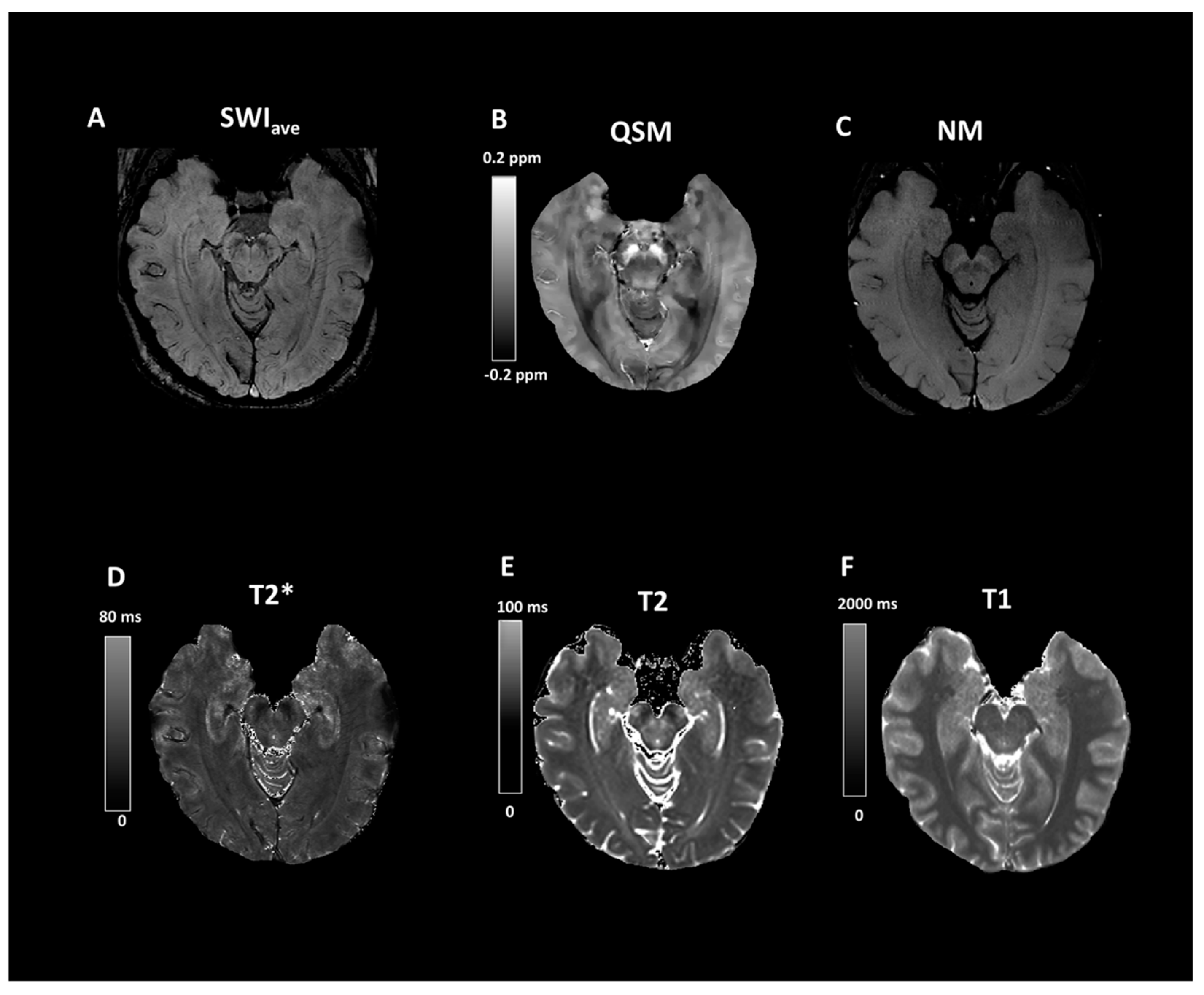 Tomography 07 00010 g005 Tomography 07 00010 g005