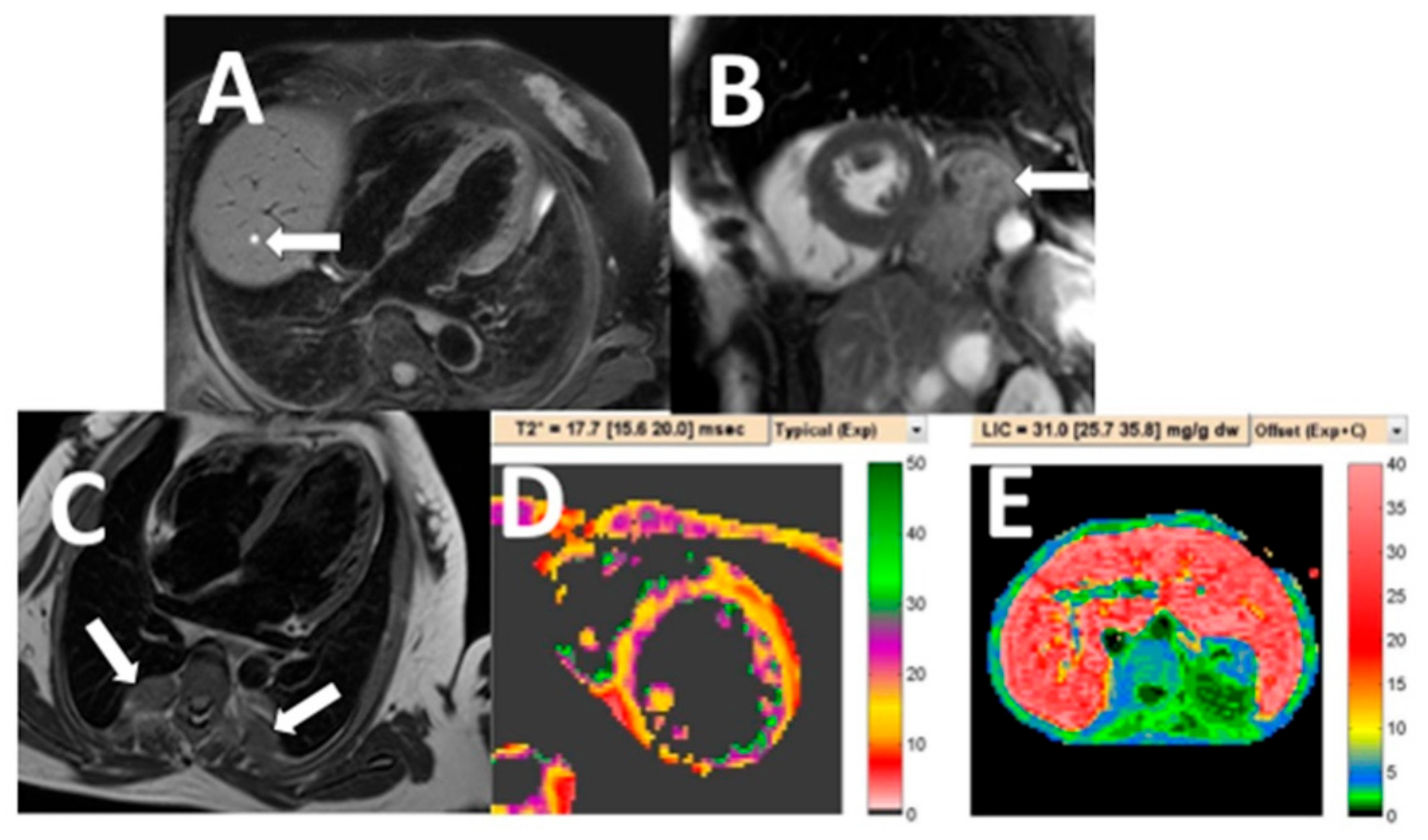 Tomography 07 00018 g001