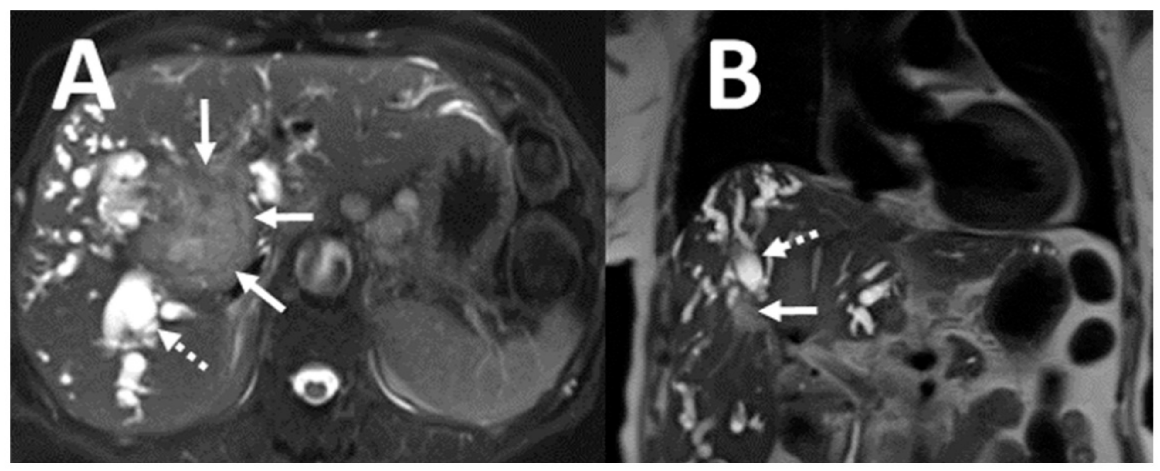 Tomography 07 00018 g002