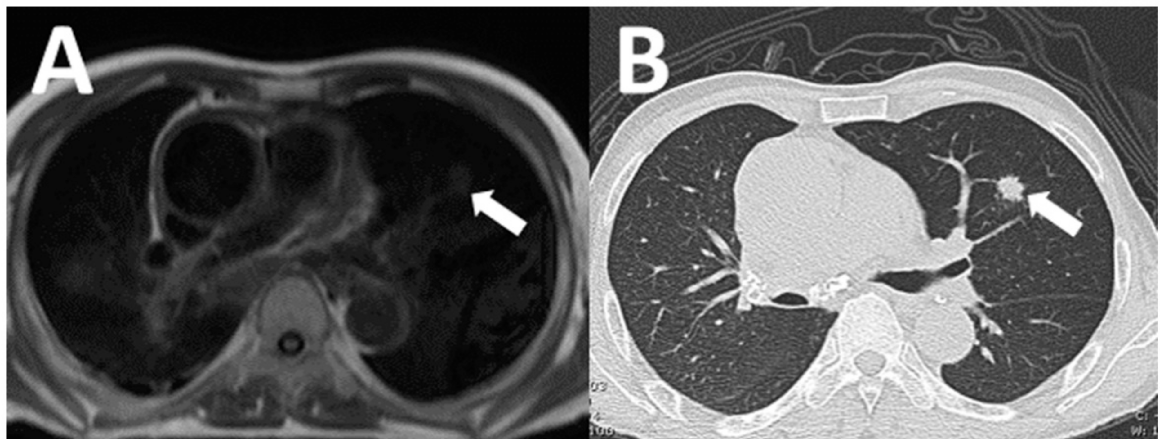 Tomography 07 00018 g003