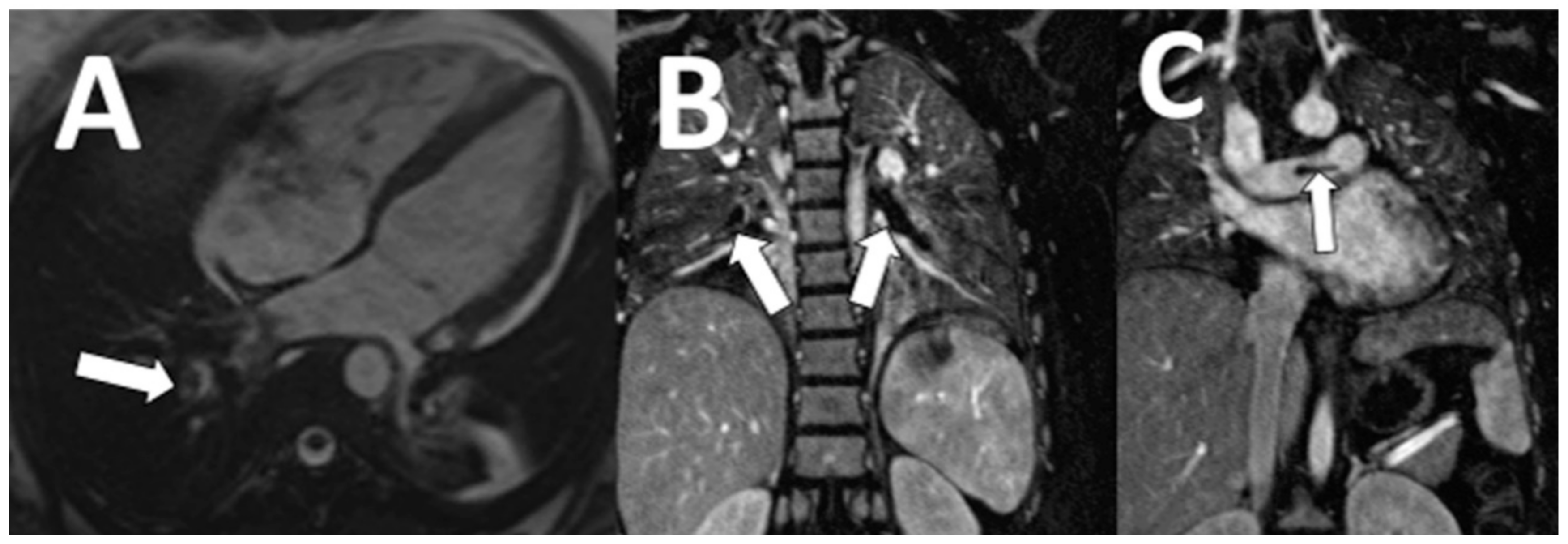 Tomography 07 00018 g004