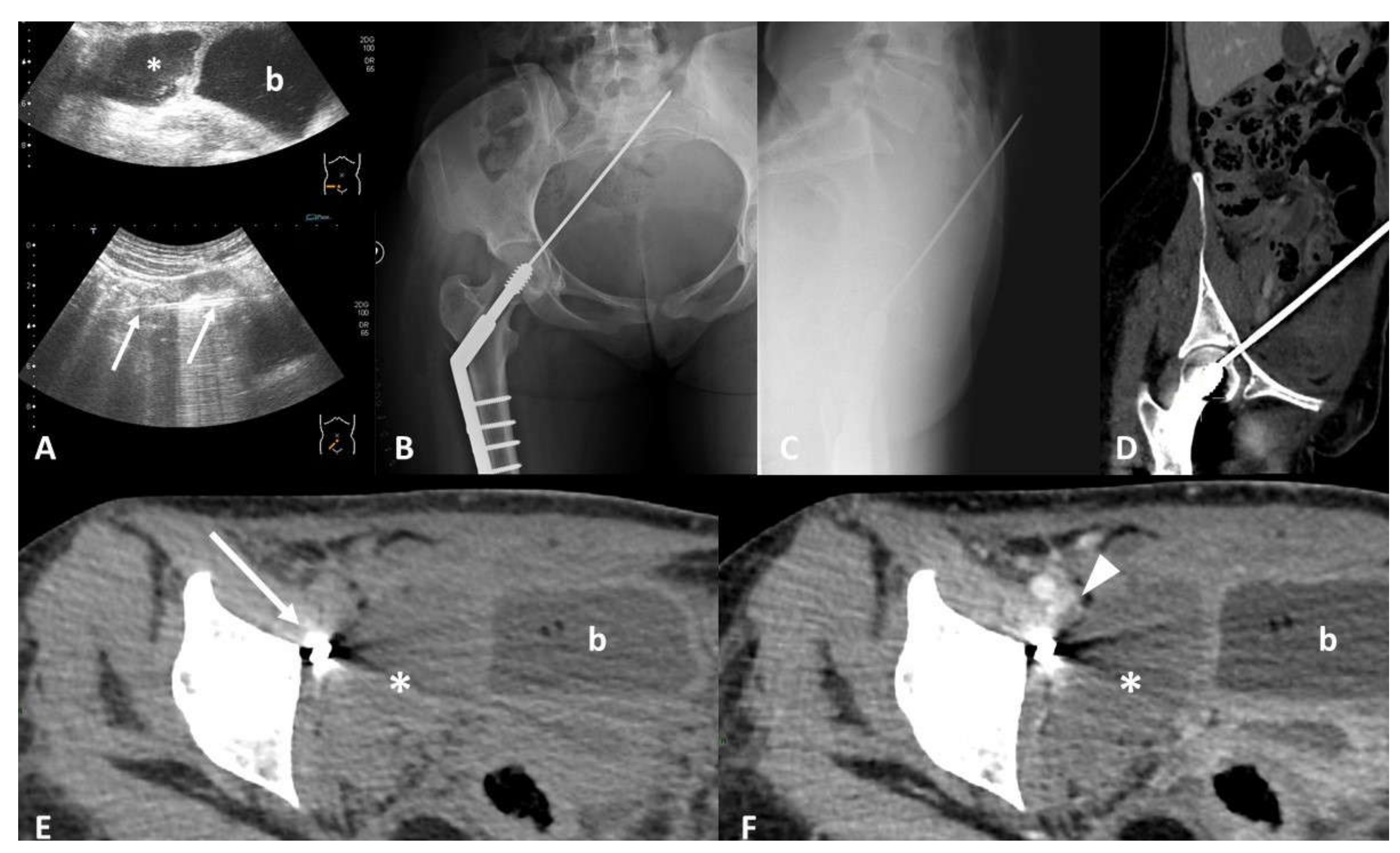 Tomography 07 00024 g001