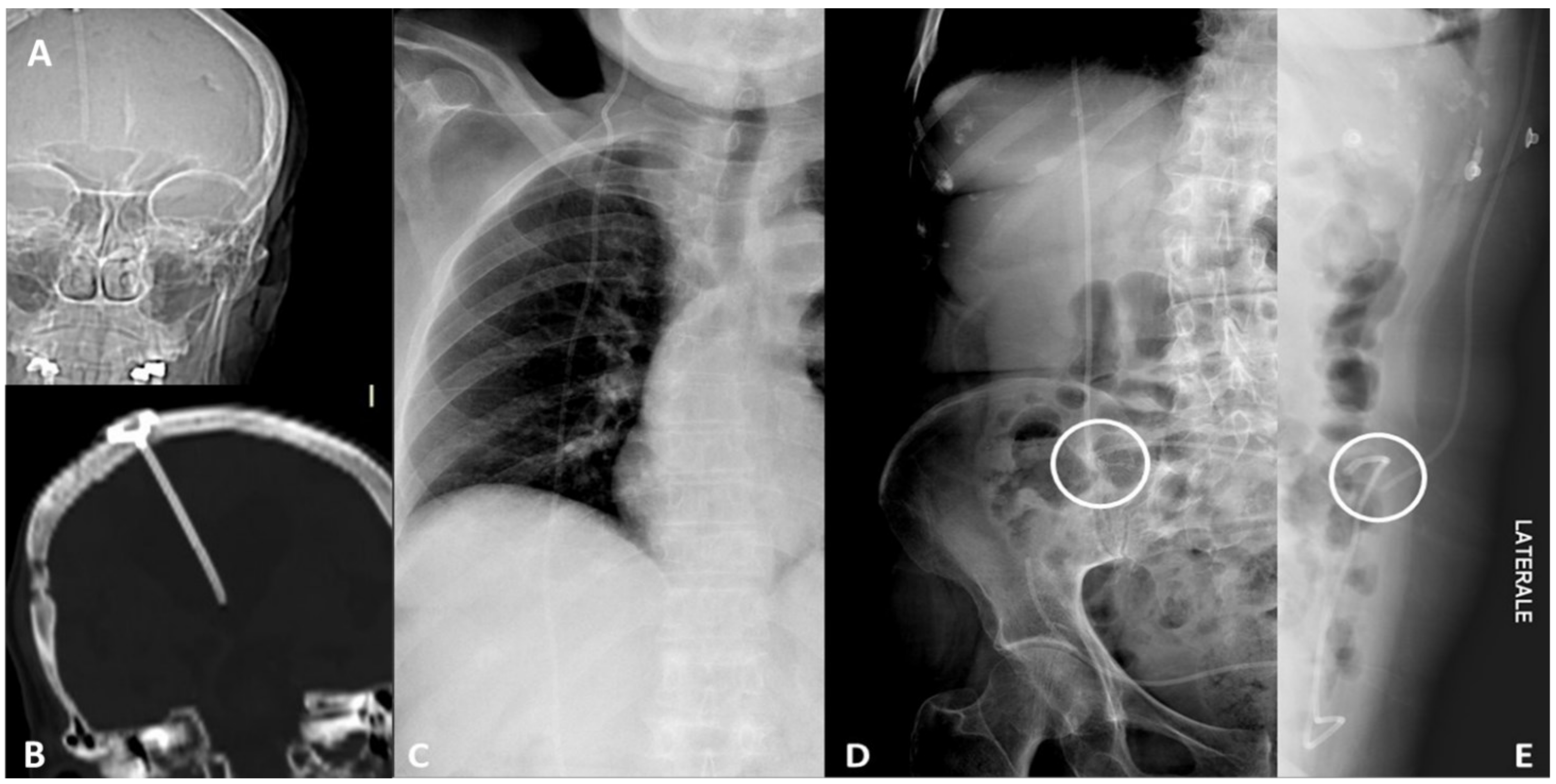 Tomography 07 00024 g002 Tomography 07 00024 g002