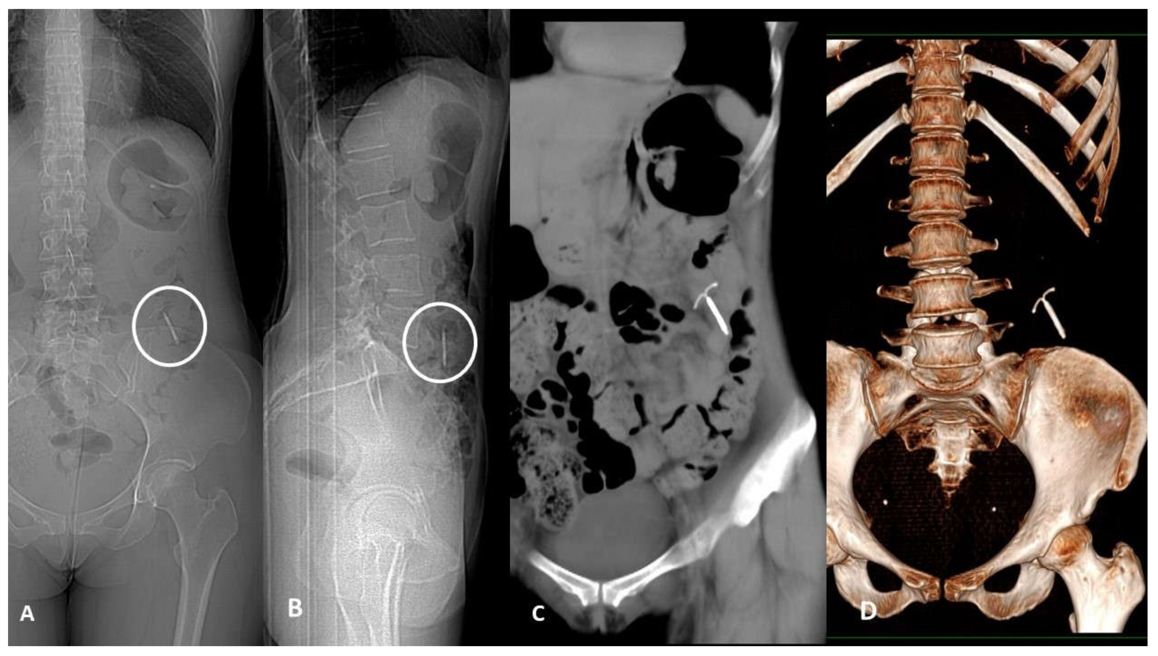 Tomography 07 00024 g003 Tomography 07 00024 g003