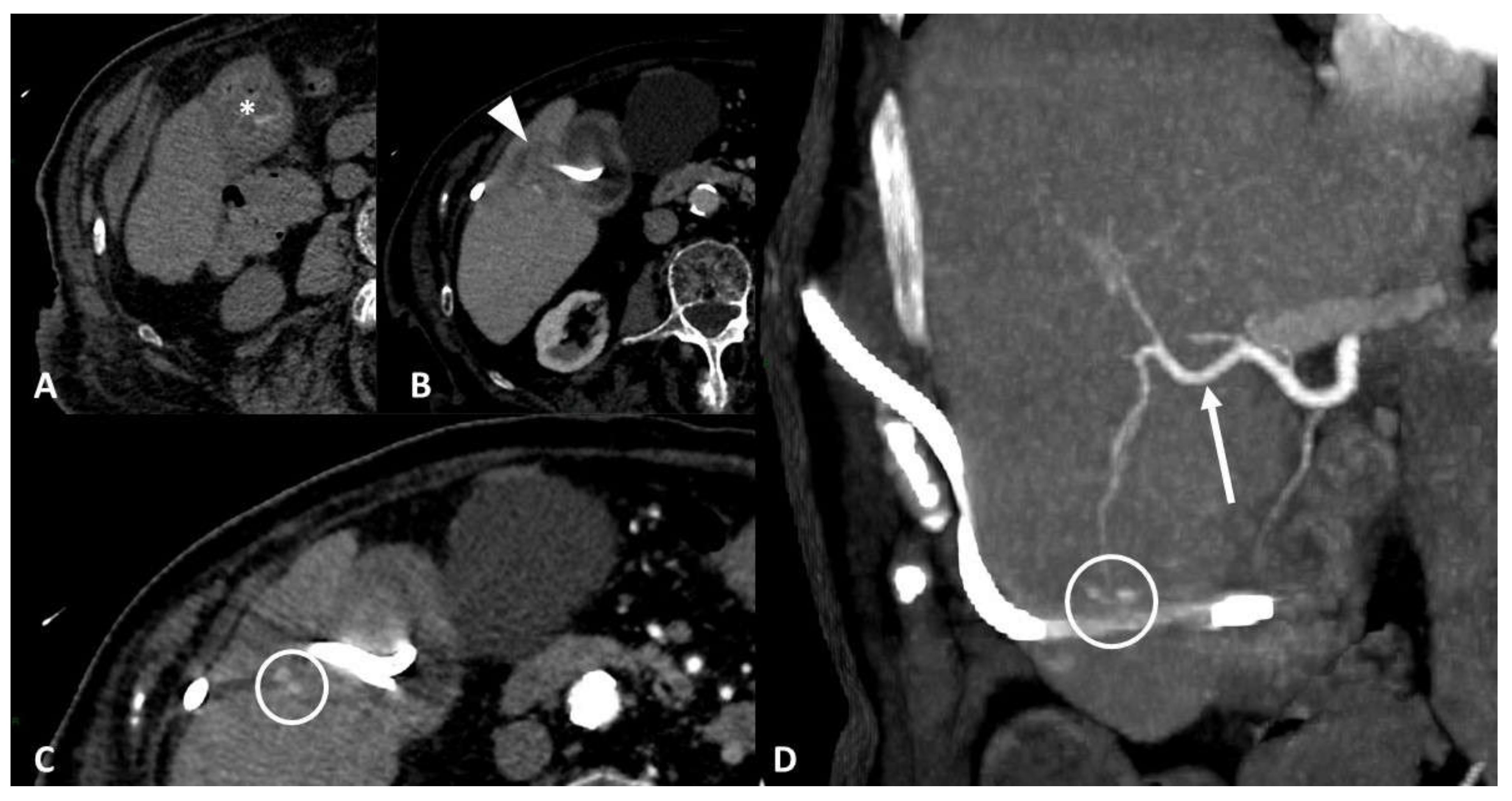Tomography 07 00024 g006 Tomography 07 00024 g006