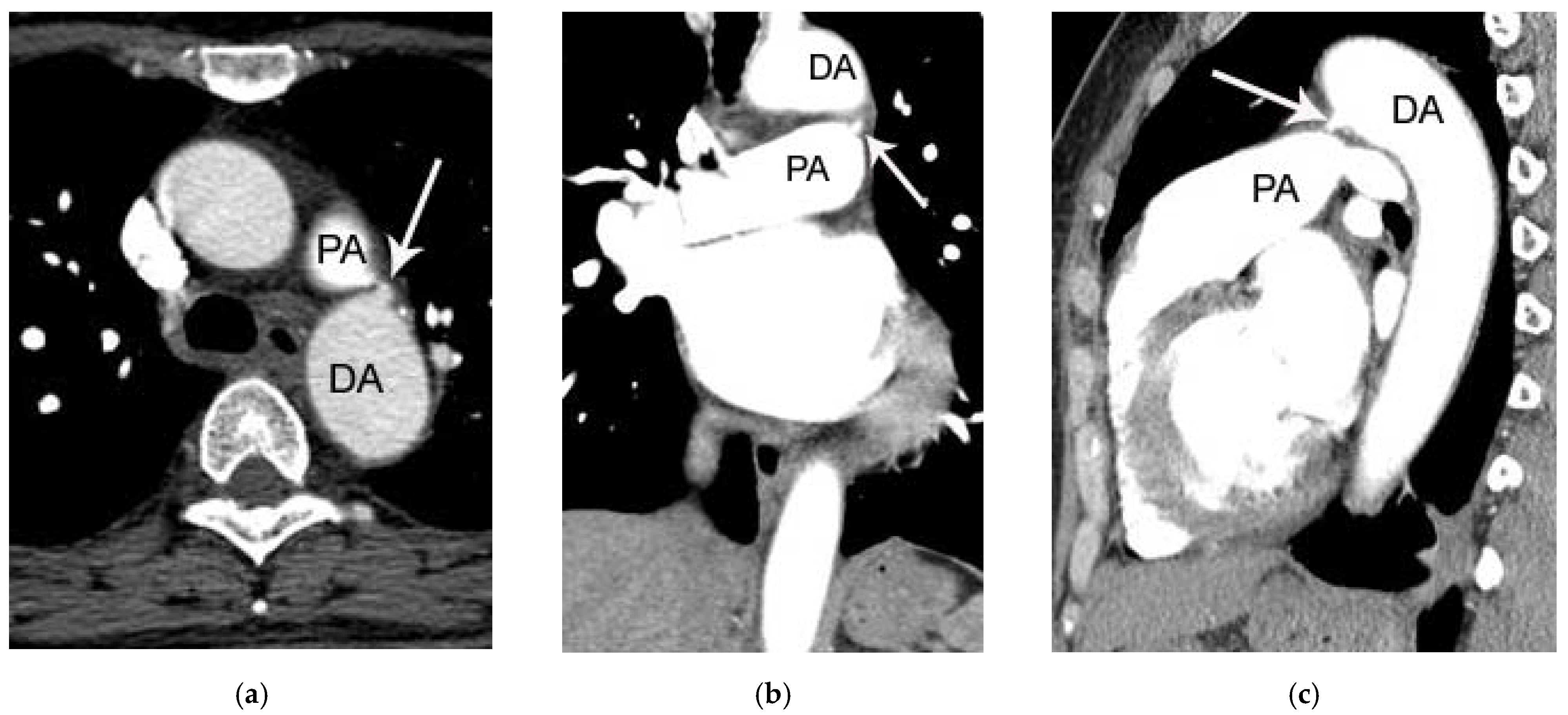 Tomography 07 00025 g003 550