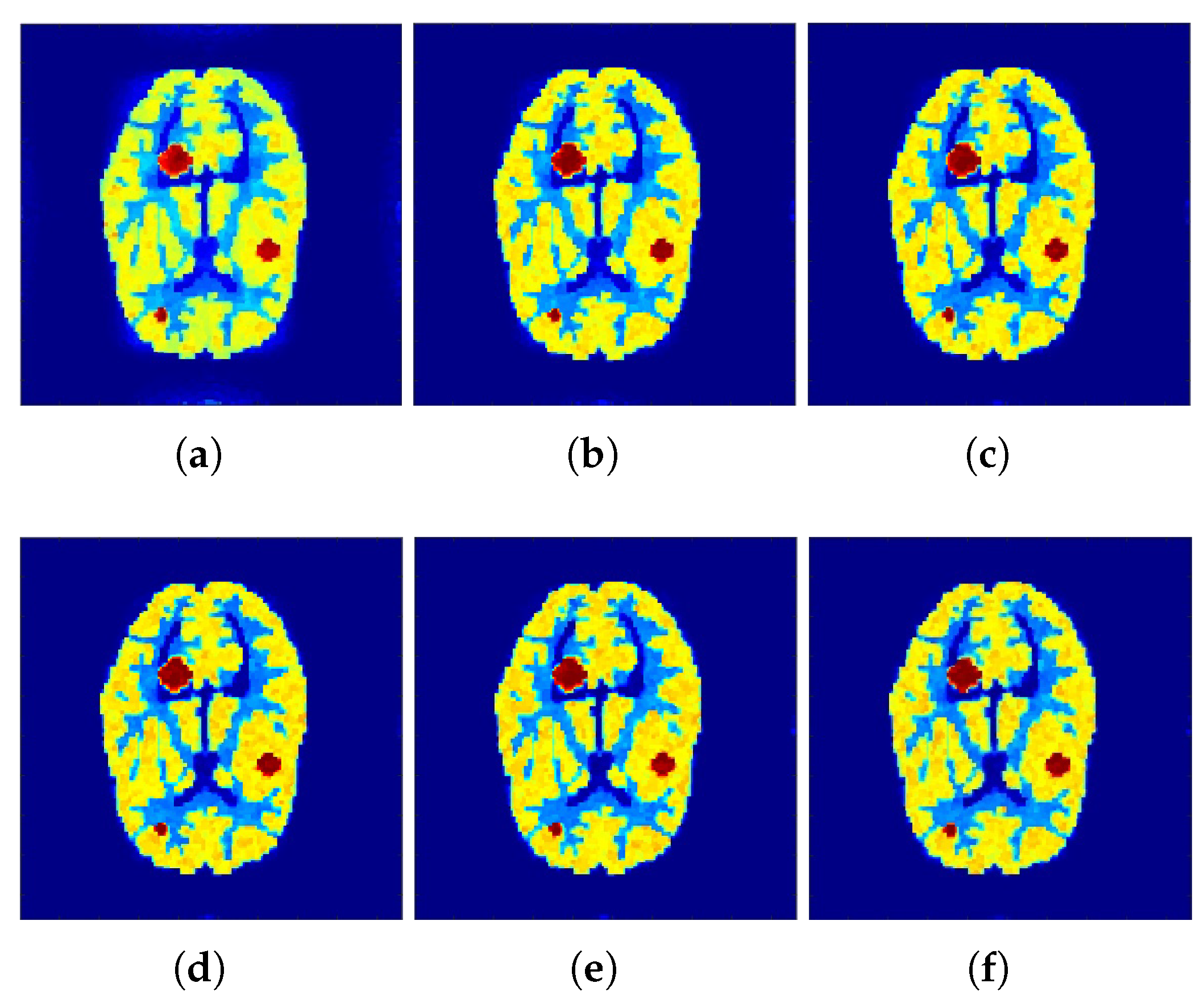 Tomography 07 00026 g004