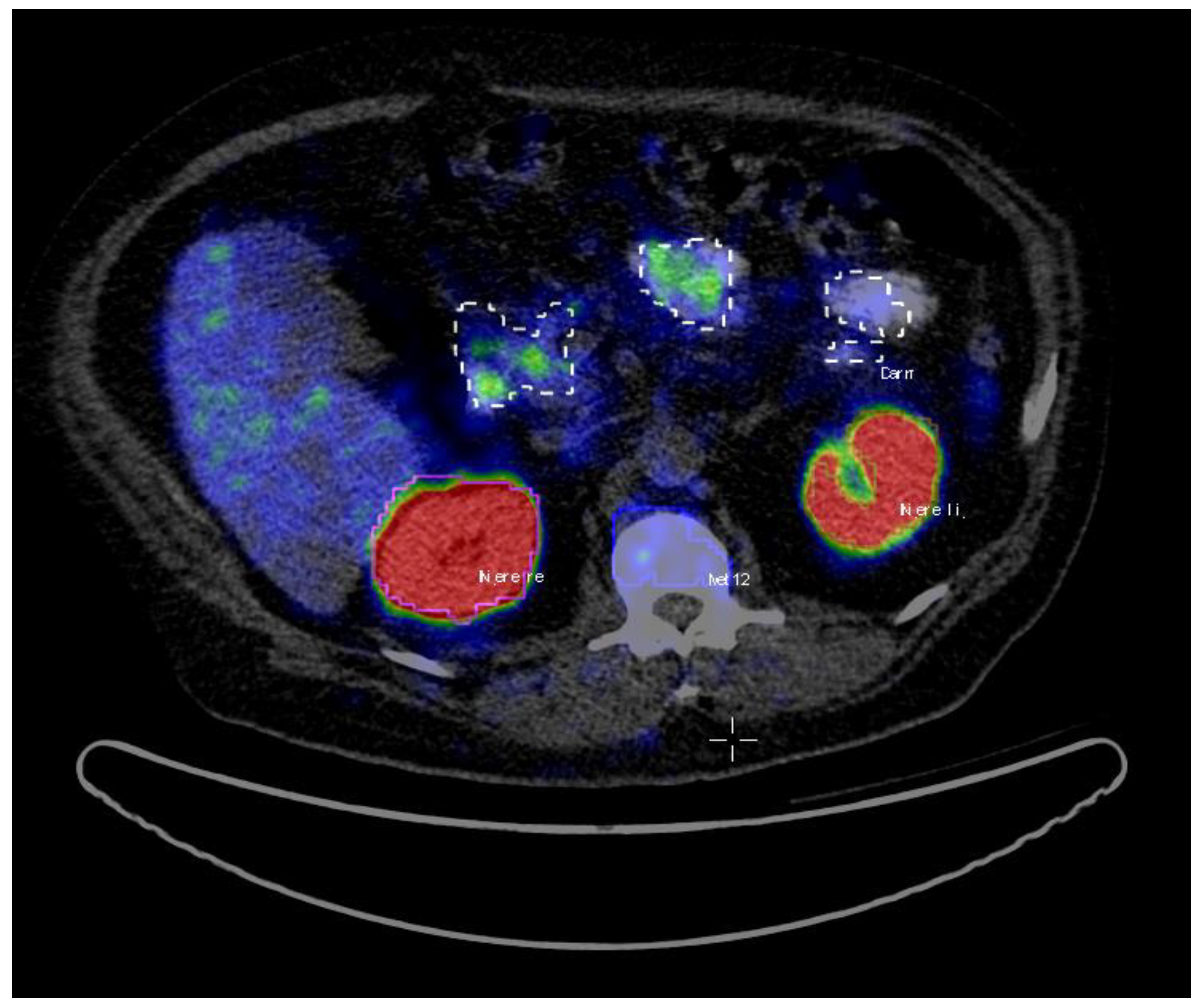 Tomography 07 00027 g001 550