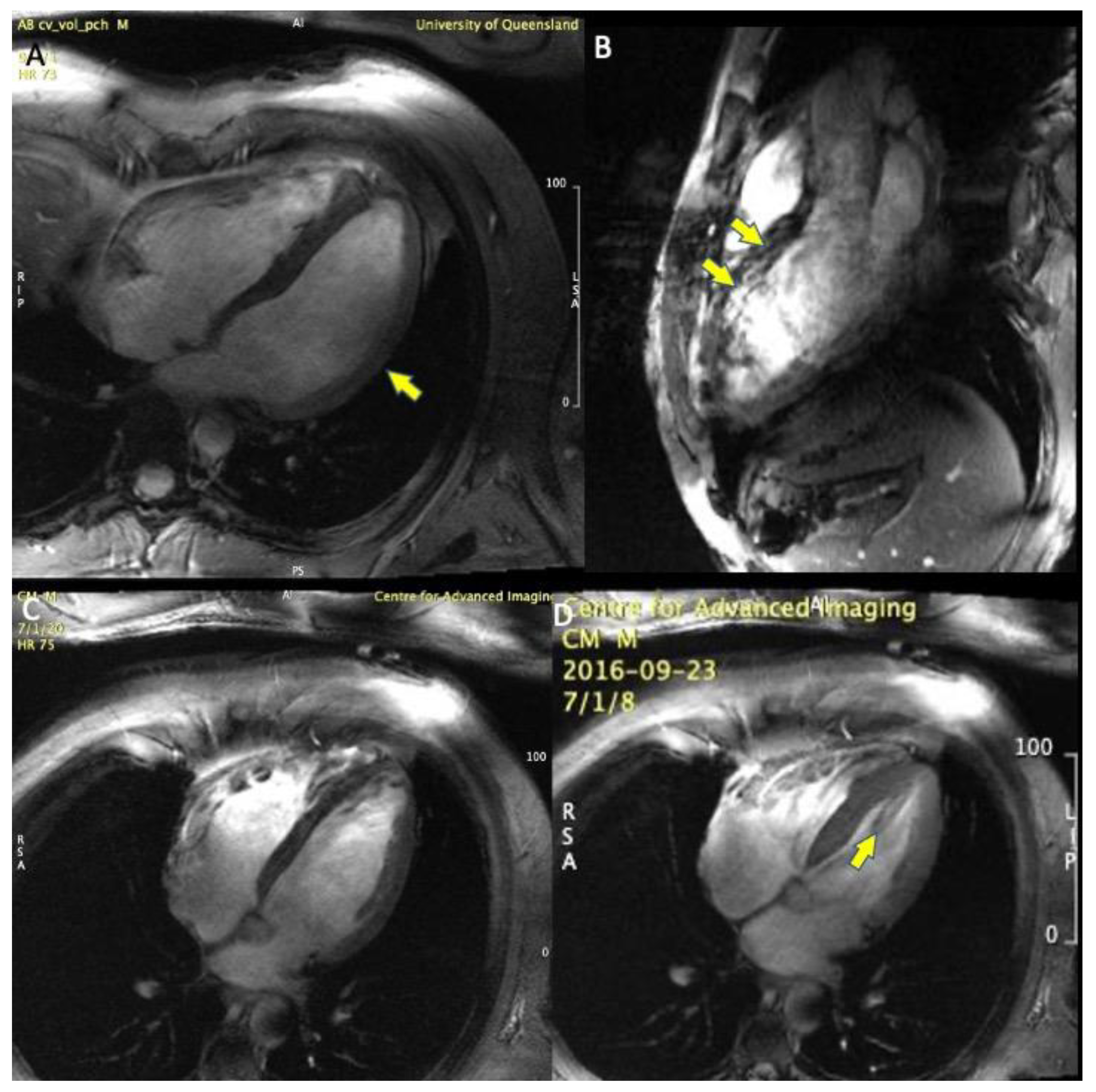 Tomography 07 00029 g003