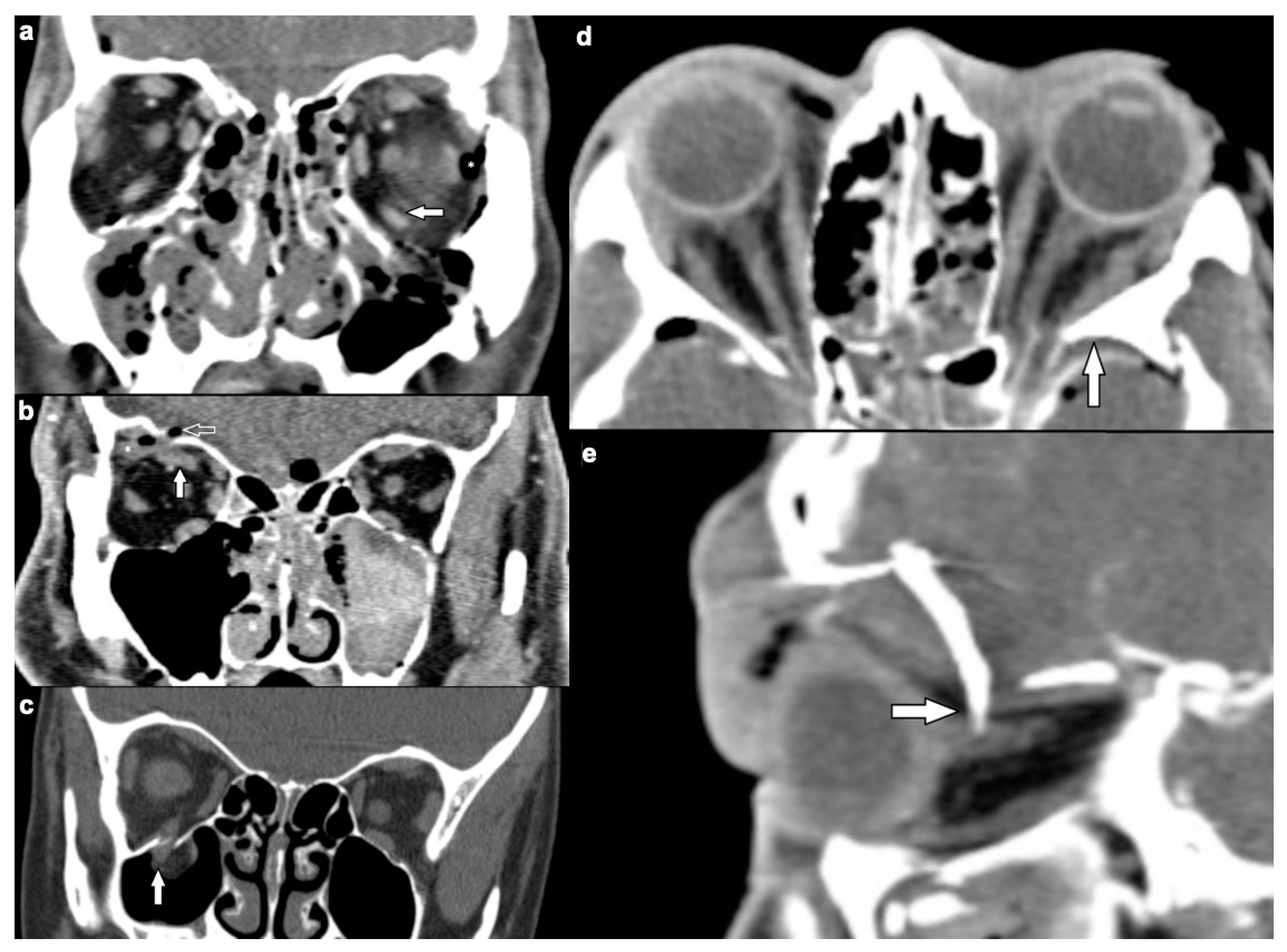 Tomography 07 00033 g002 550