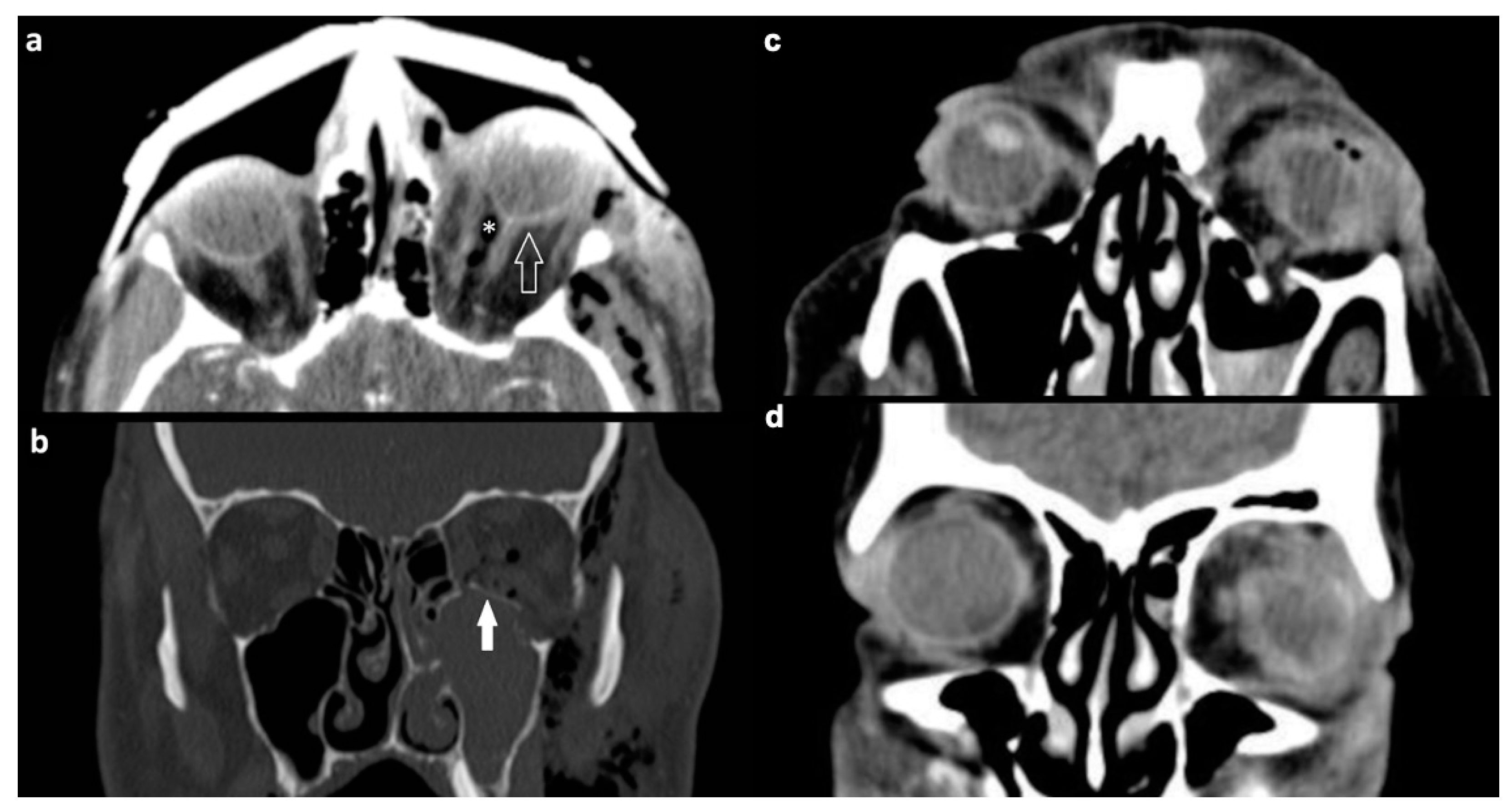 Tomography 07 00033 g003 550