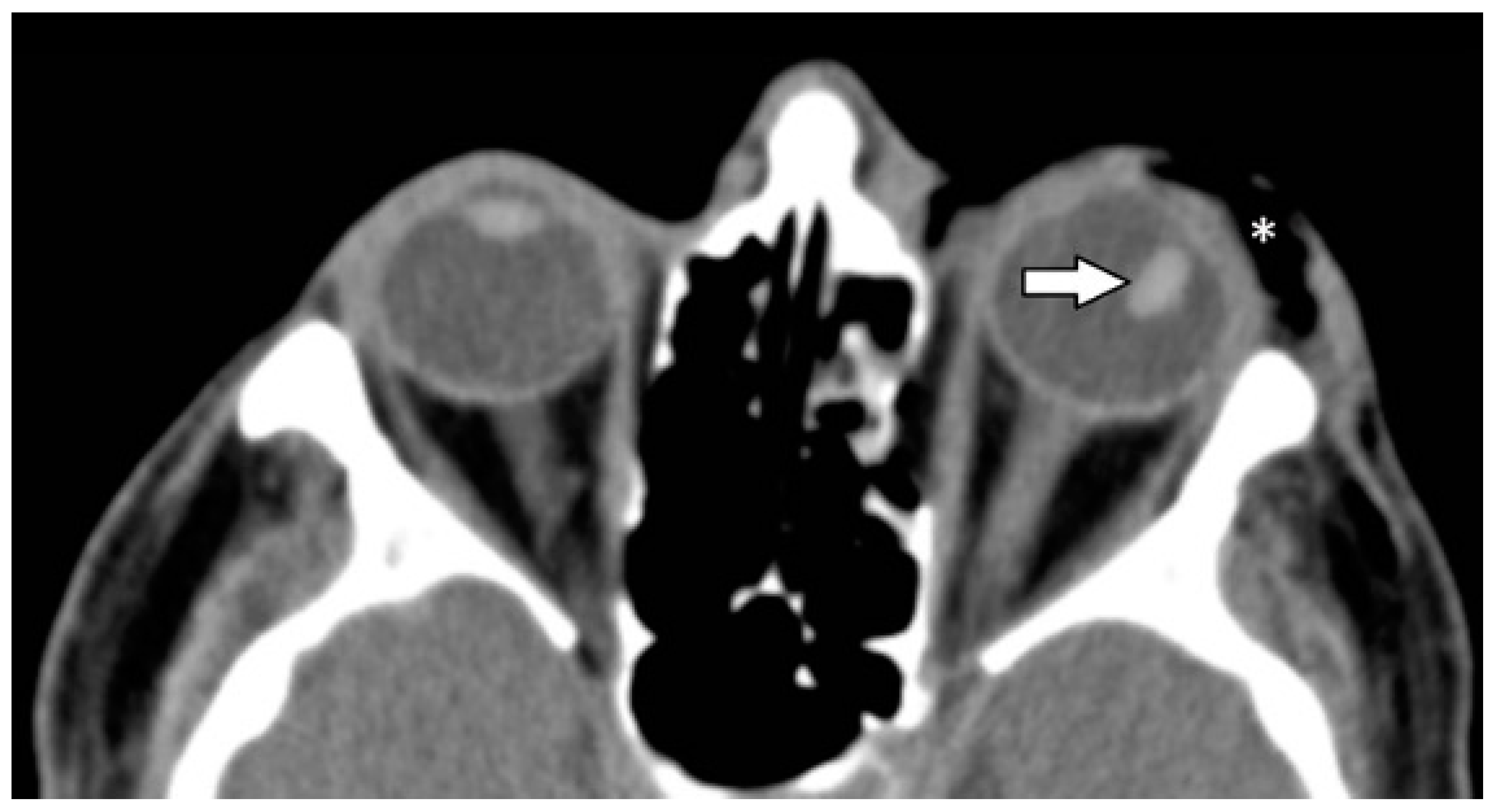 Tomography 07 00033 g004 550
