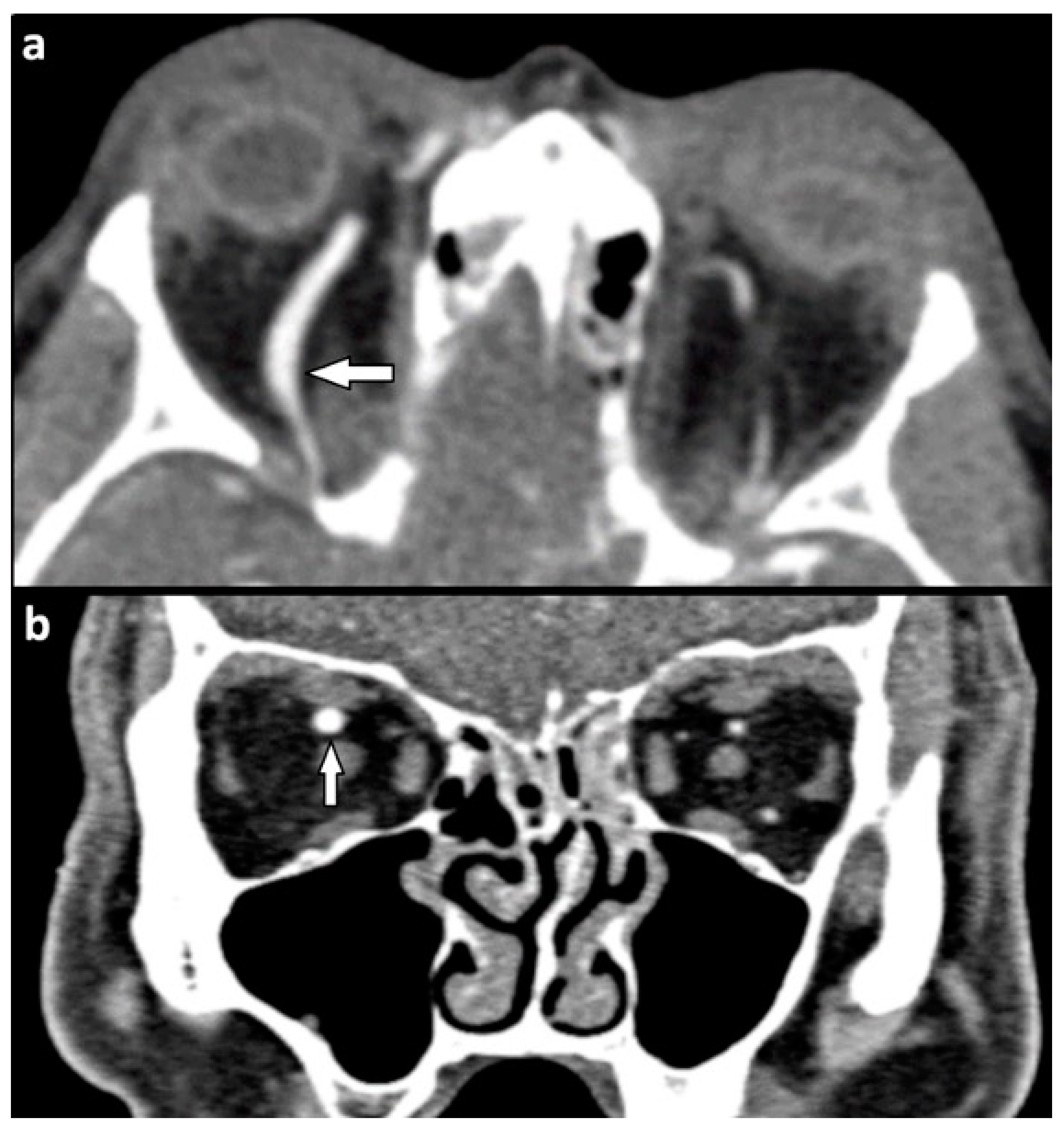Tomography 07 00033 g006 550