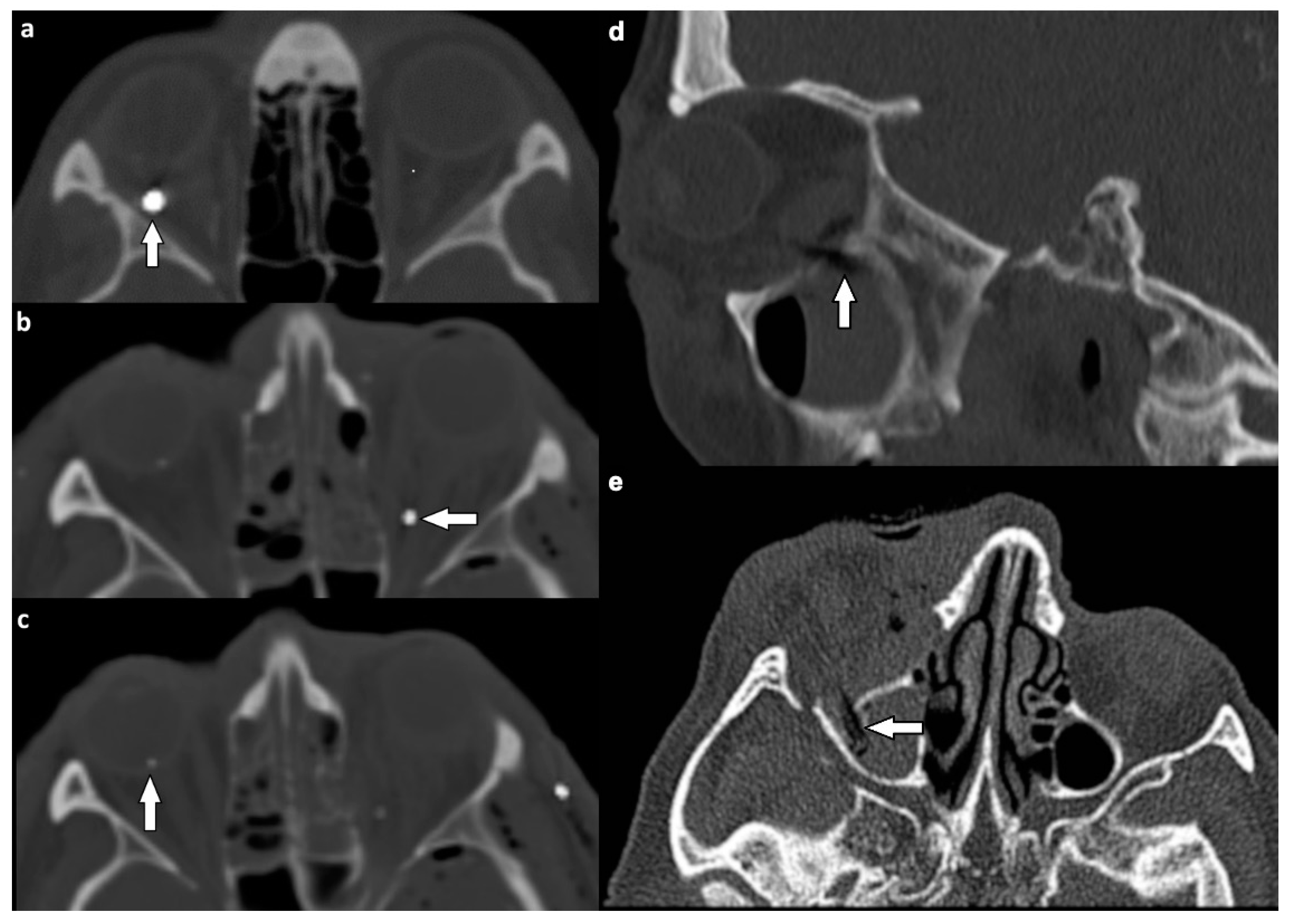 Tomography 07 00033 g007 550