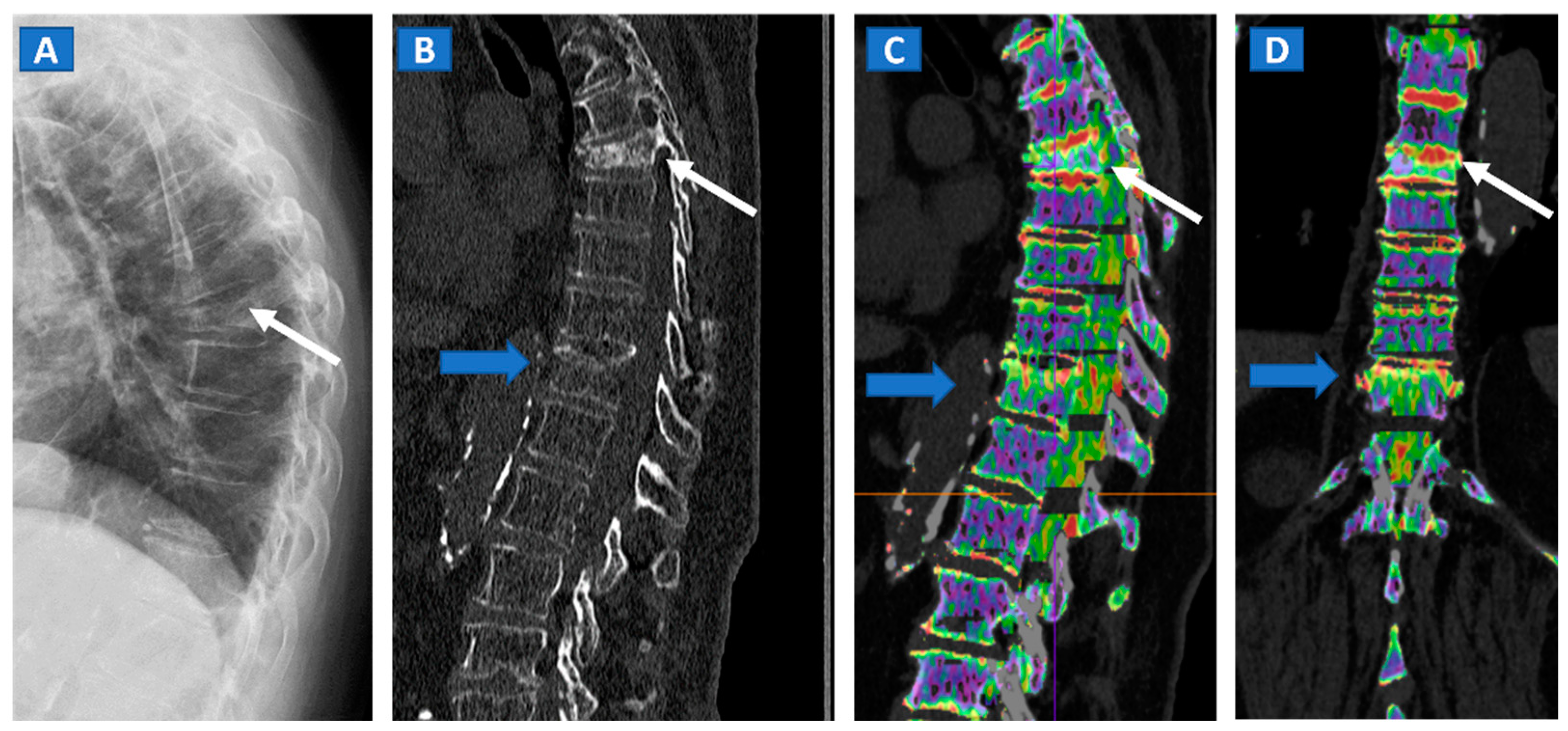 Tomography 07 00034 g001