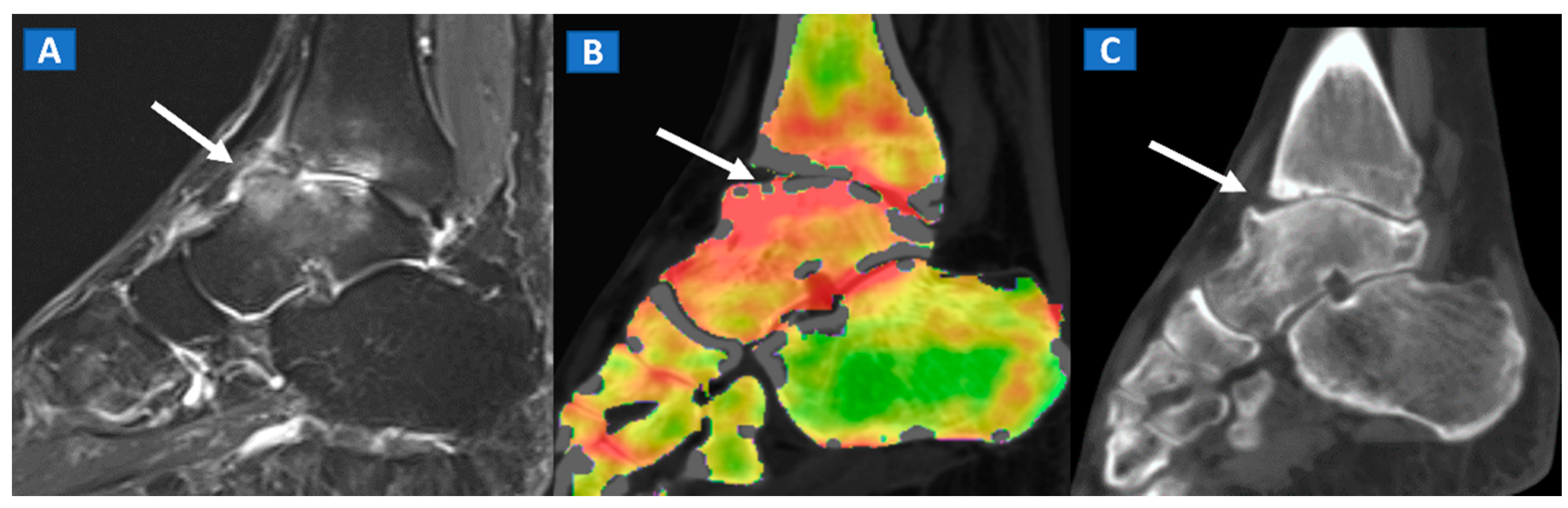 Tomography 07 00034 g003