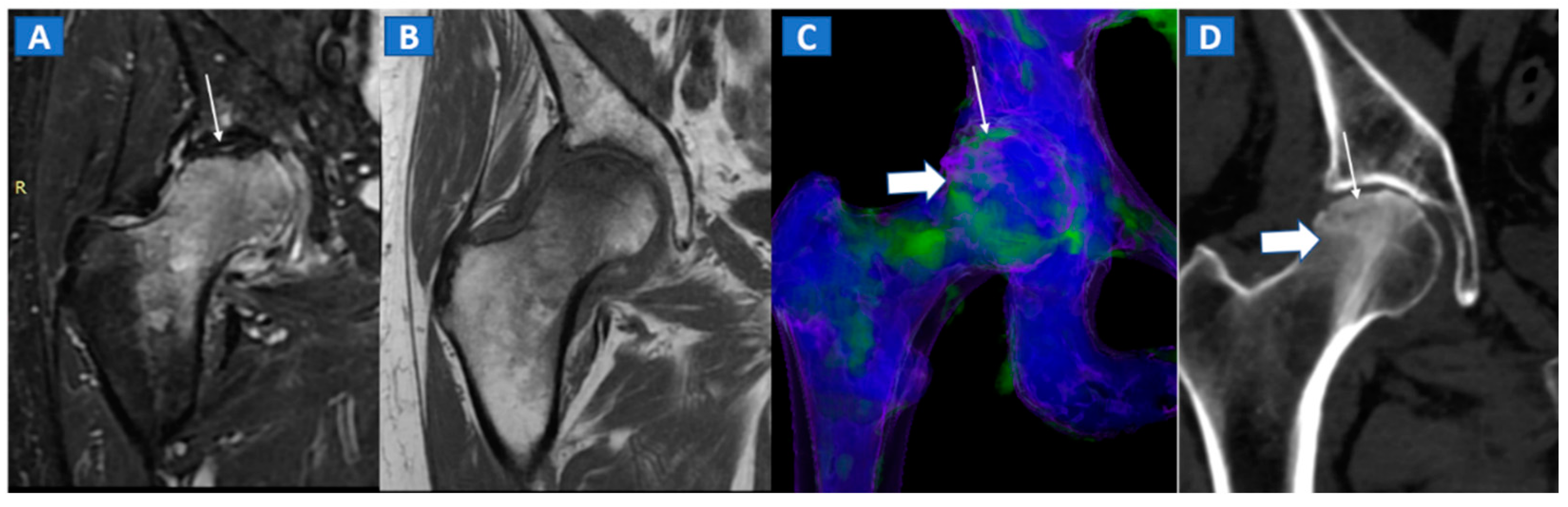 Tomography 07 00034 g005