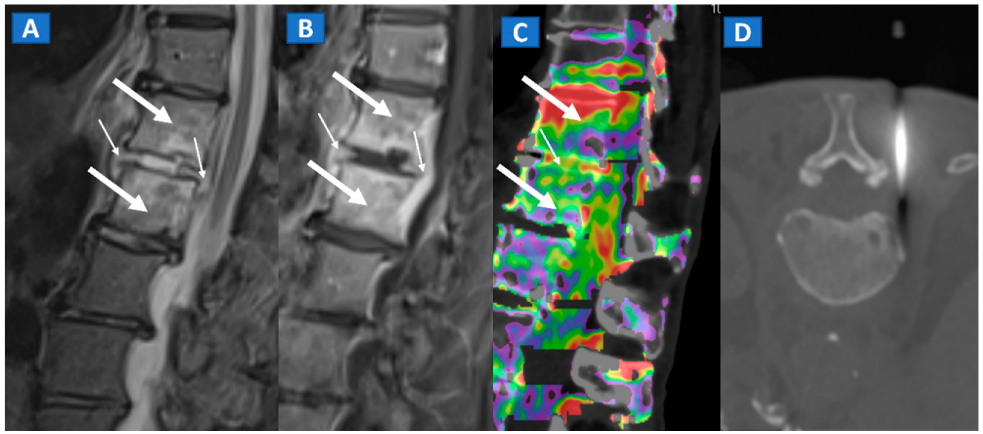 Tomography 07 00034 g010