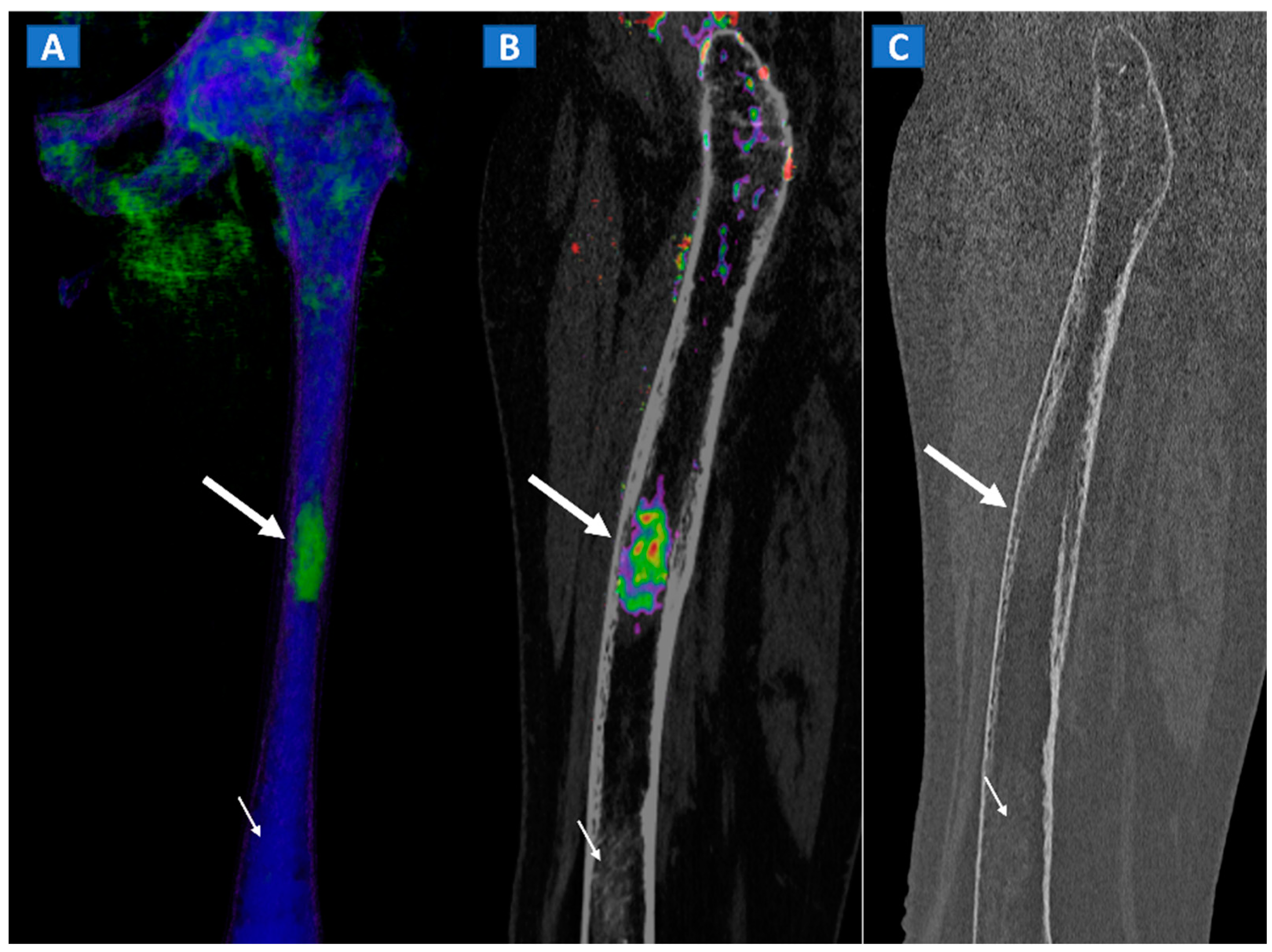 Tomography 07 00034 g011