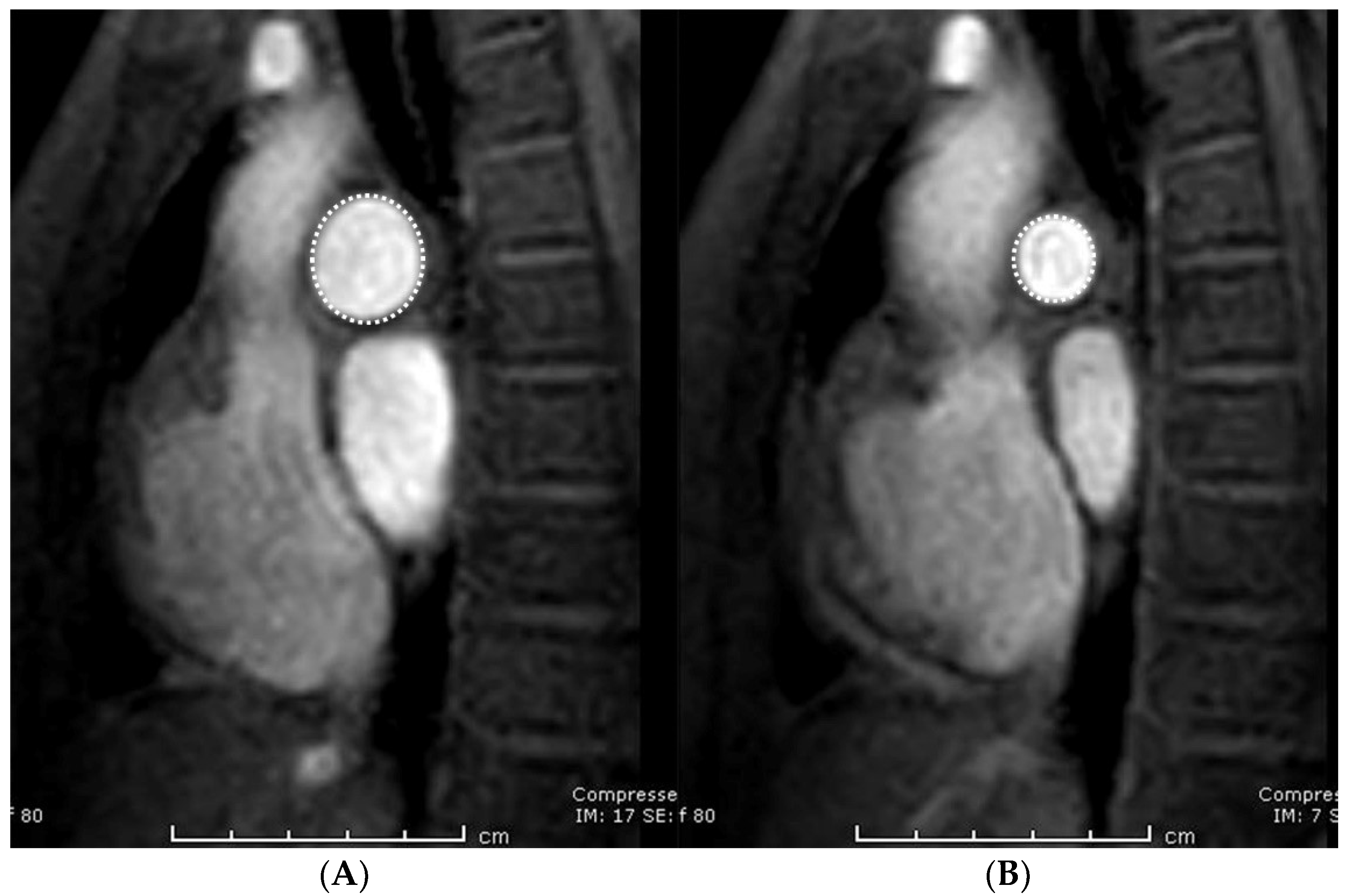 Tomography 07 00036 g003
