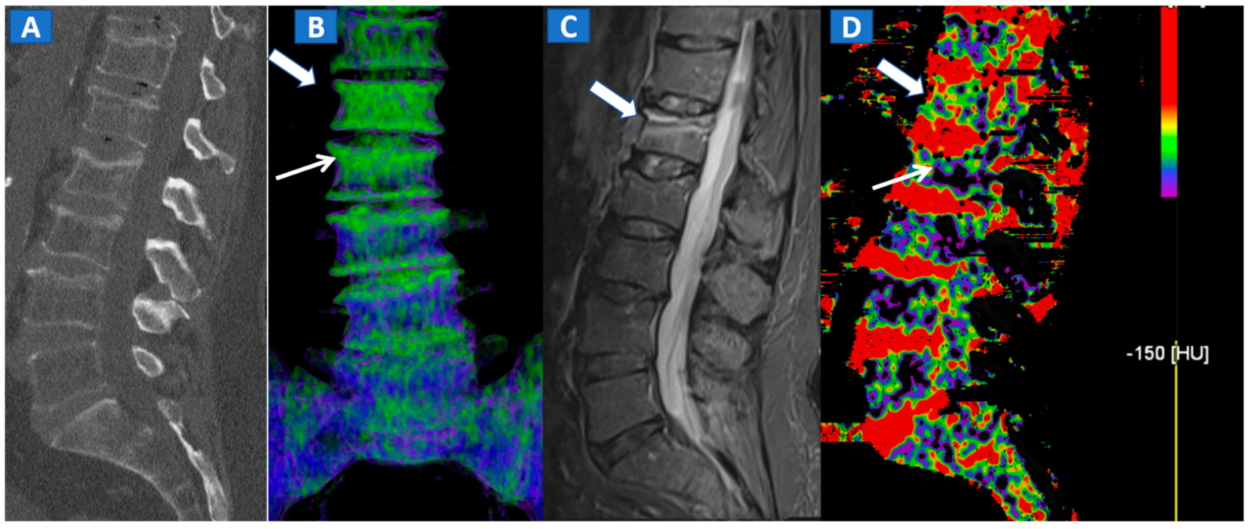 Tomography 07 00037 g002
