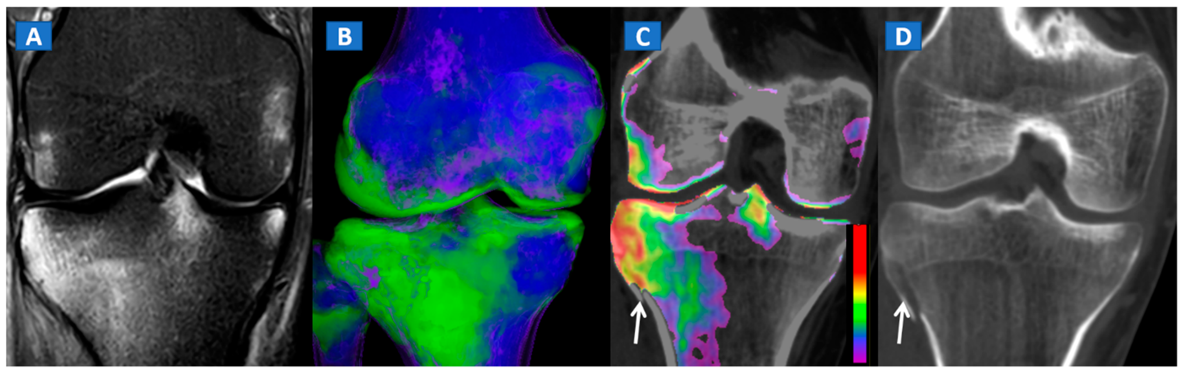 Tomography 07 00037 g005