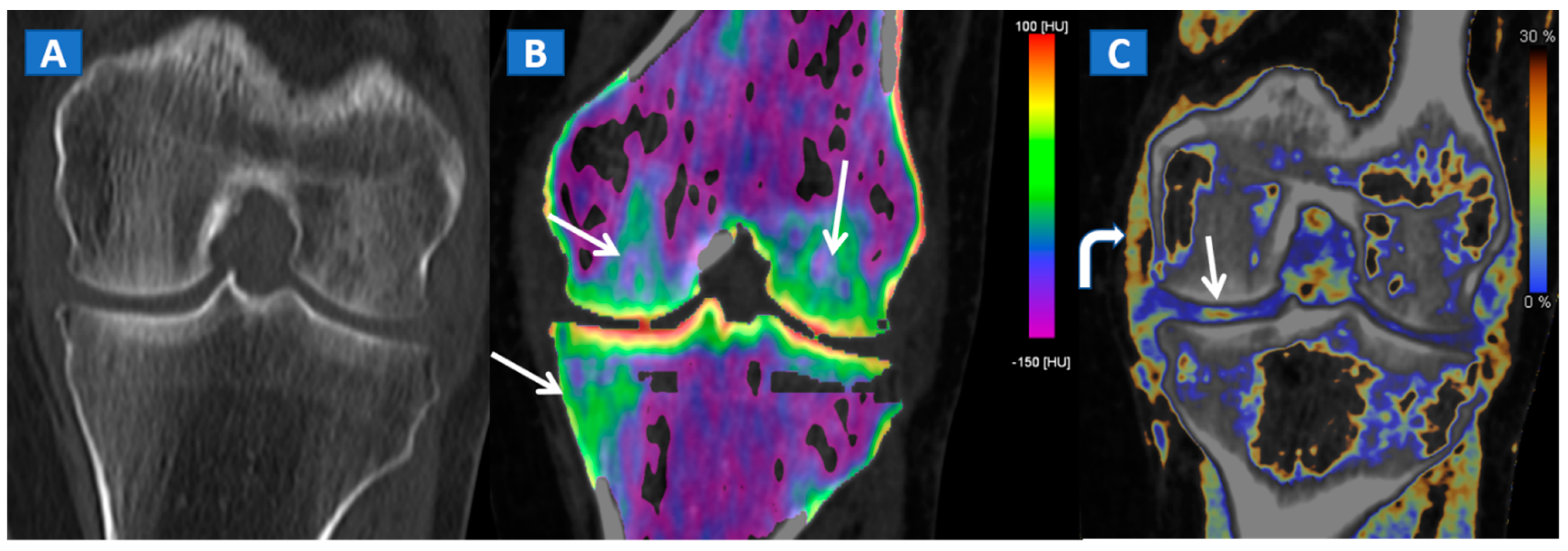 Tomography 07 00037 g006