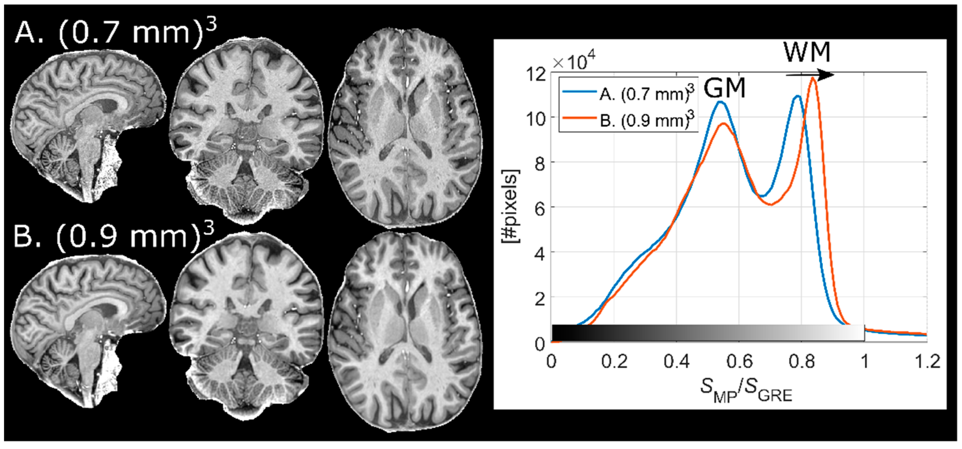 Tomography 07 00038 g003 550