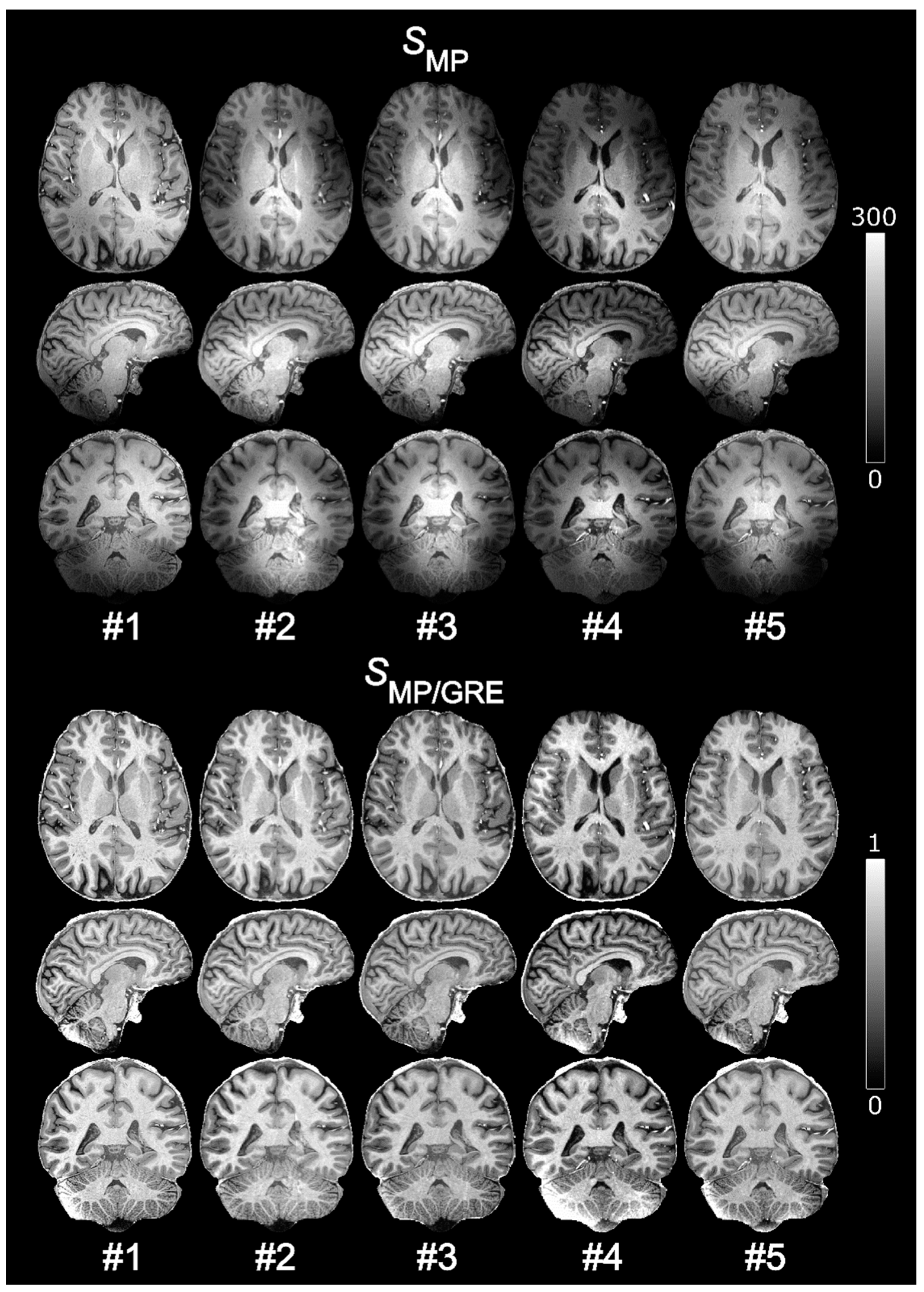 Tomography 07 00038 g004 550