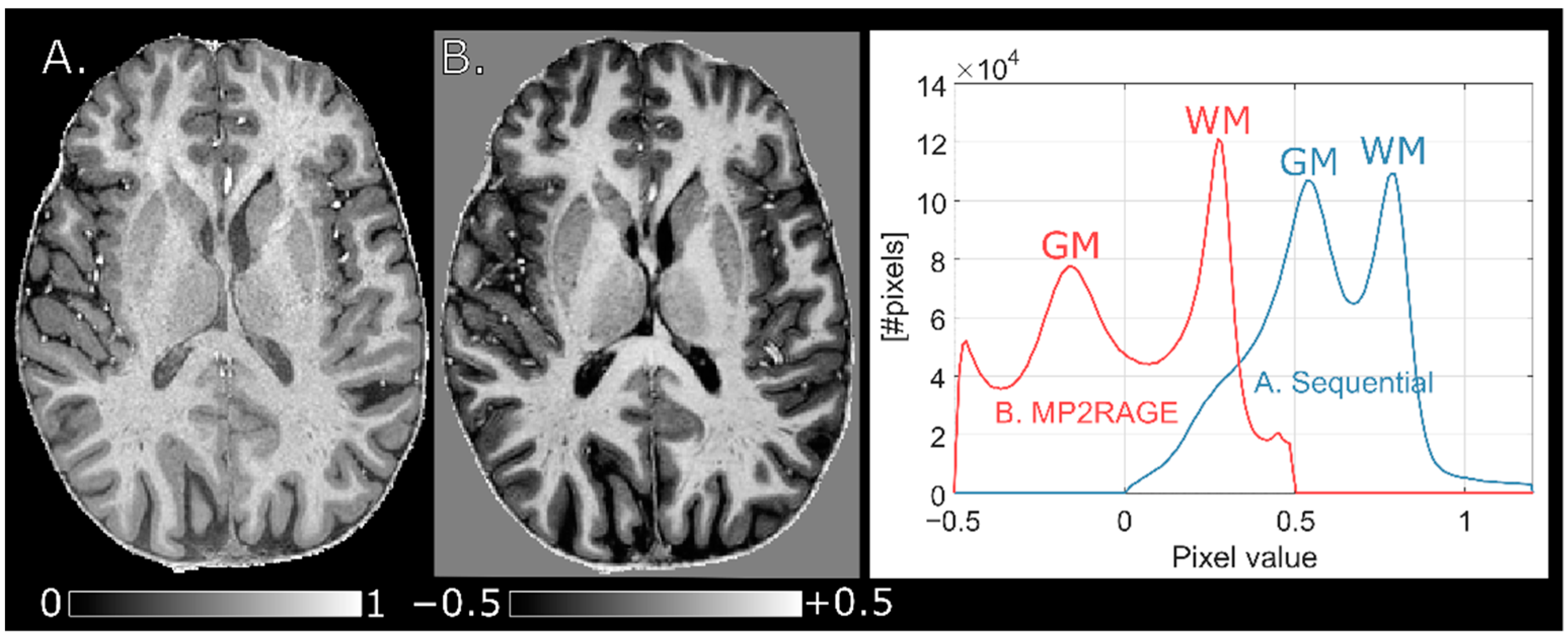 Tomography 07 00038 g006 550