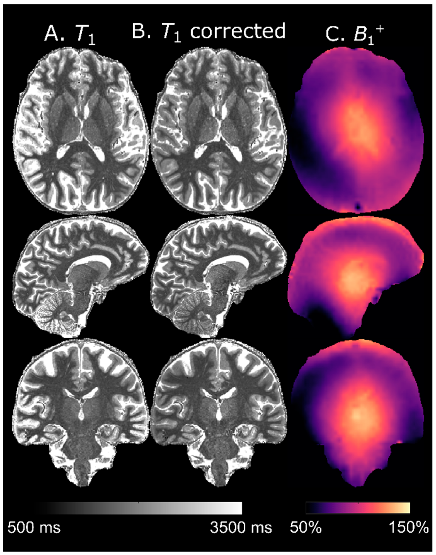 Tomography 07 00038 g008 550