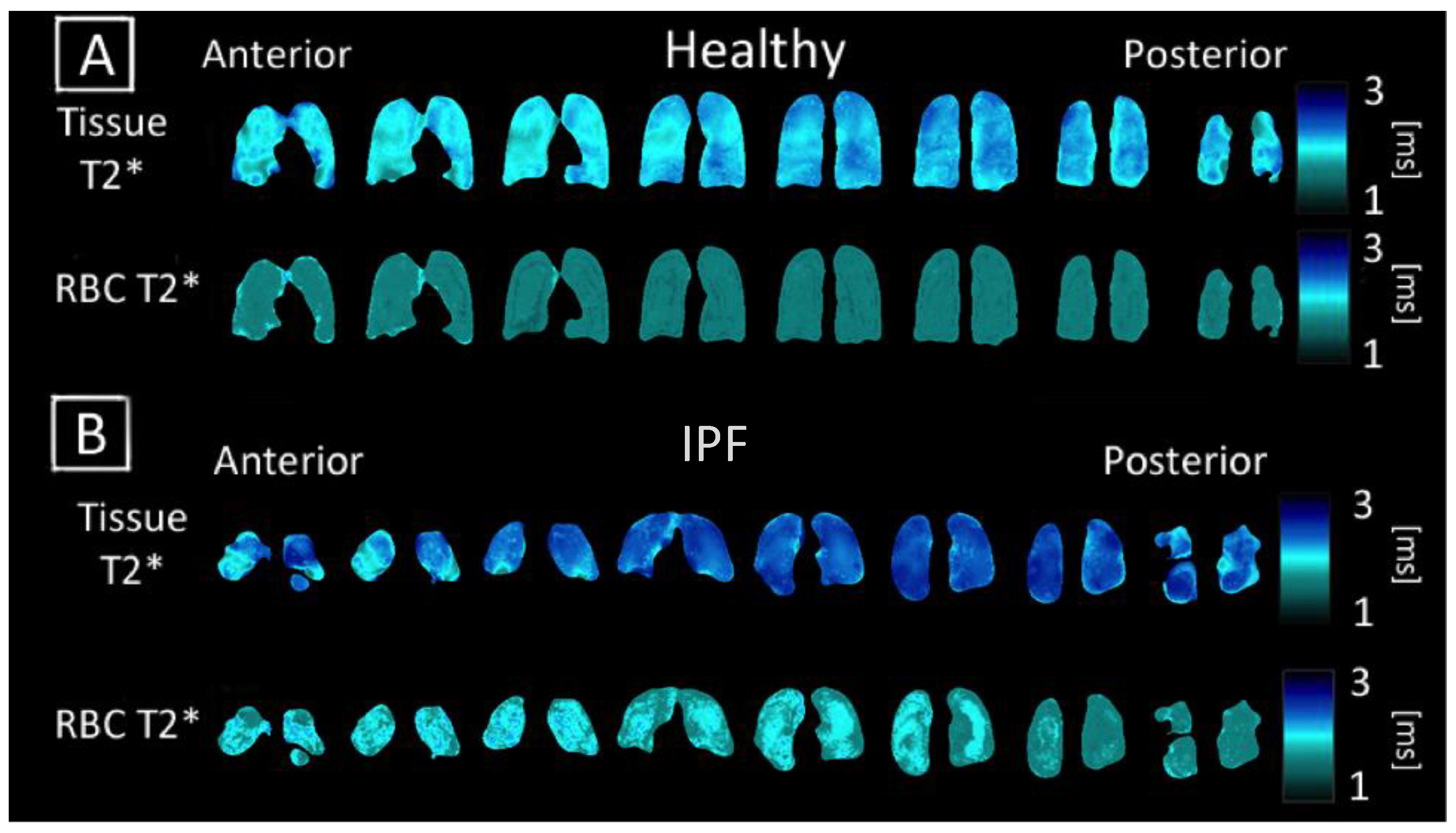 Tomography 07 00039 g004 550