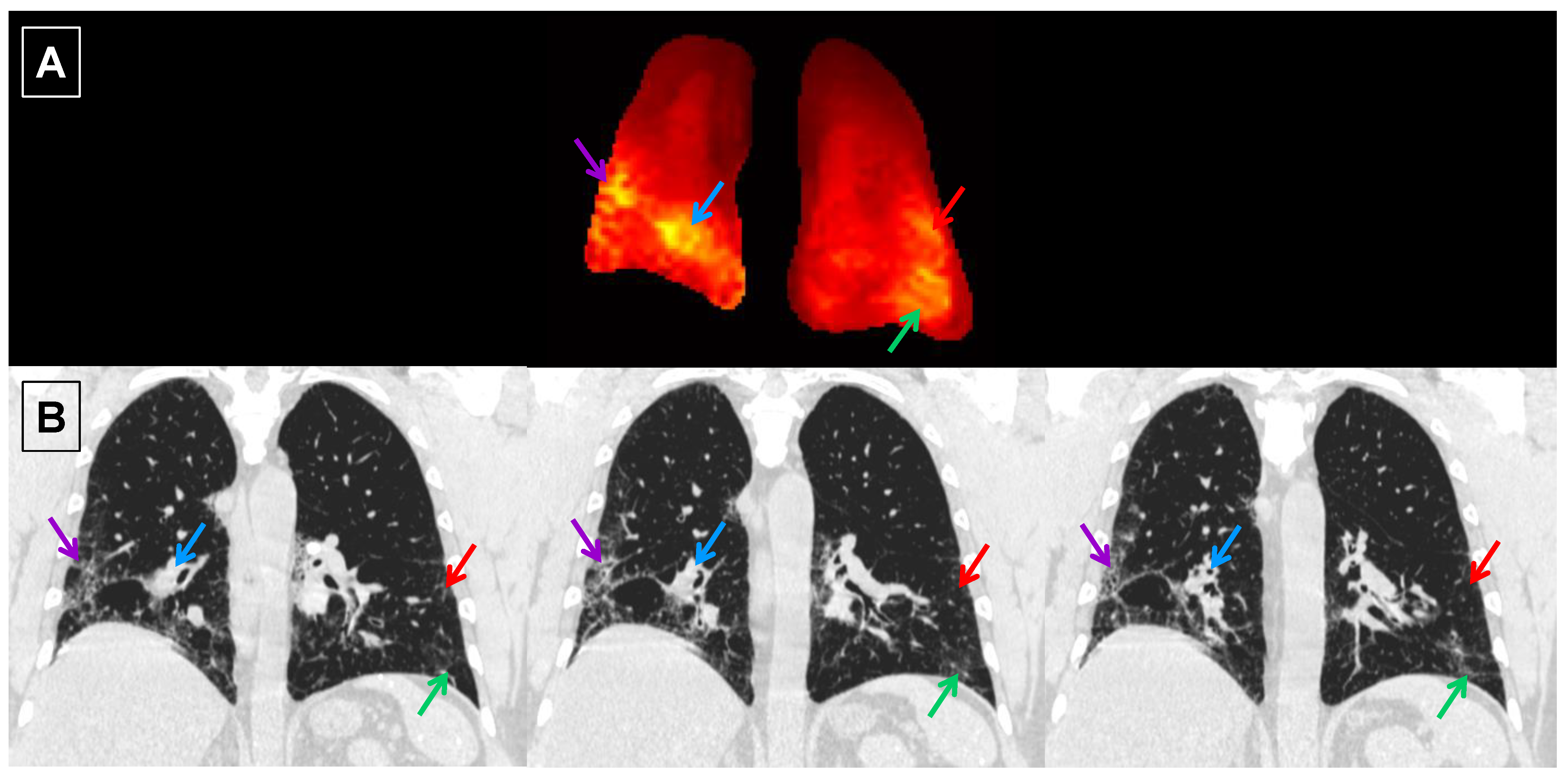 Tomography 07 00039 g008 550
